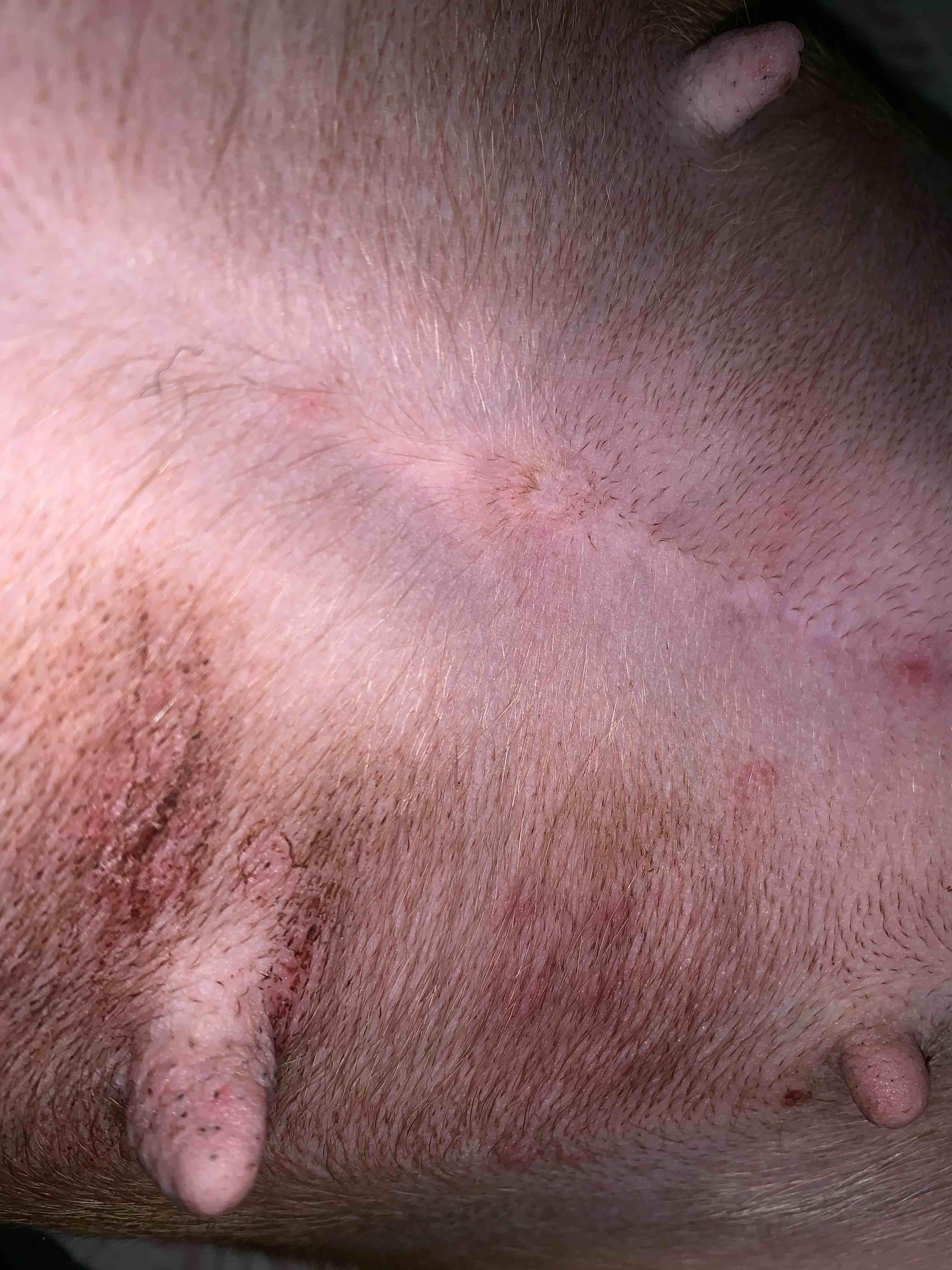 Question details sensitive content