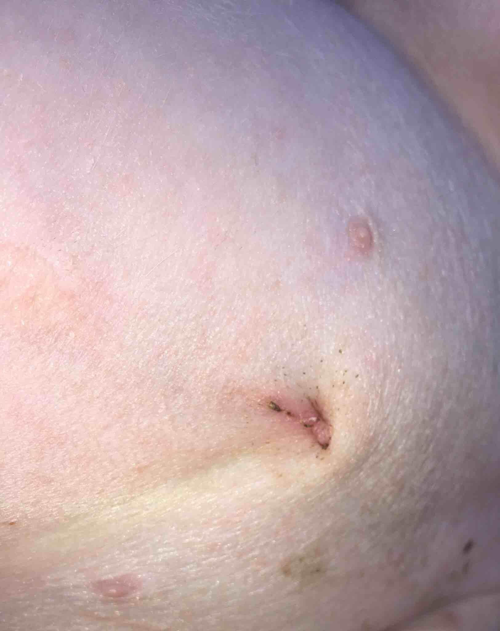 Question details sensitive content