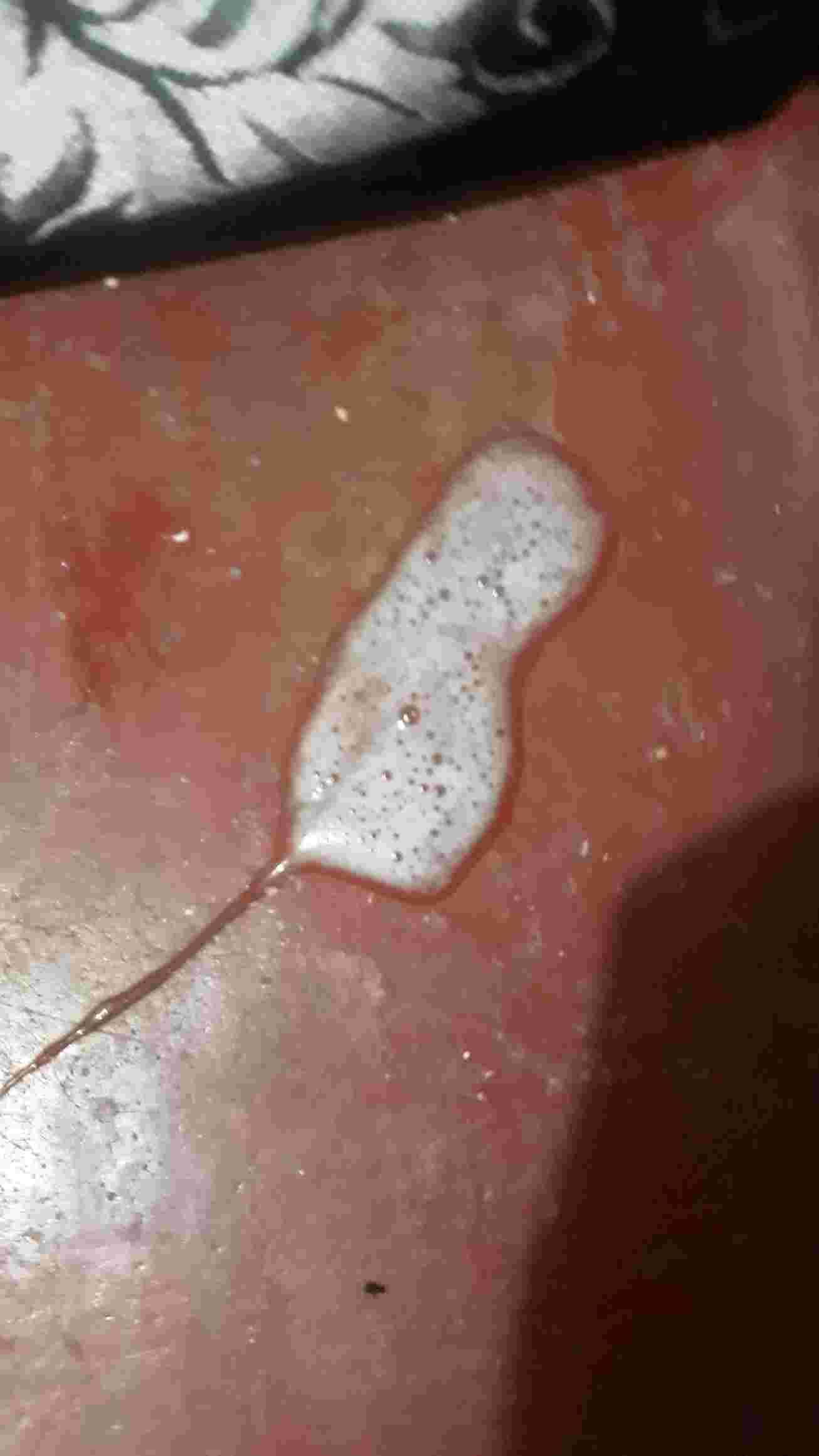 Question details sensitive content