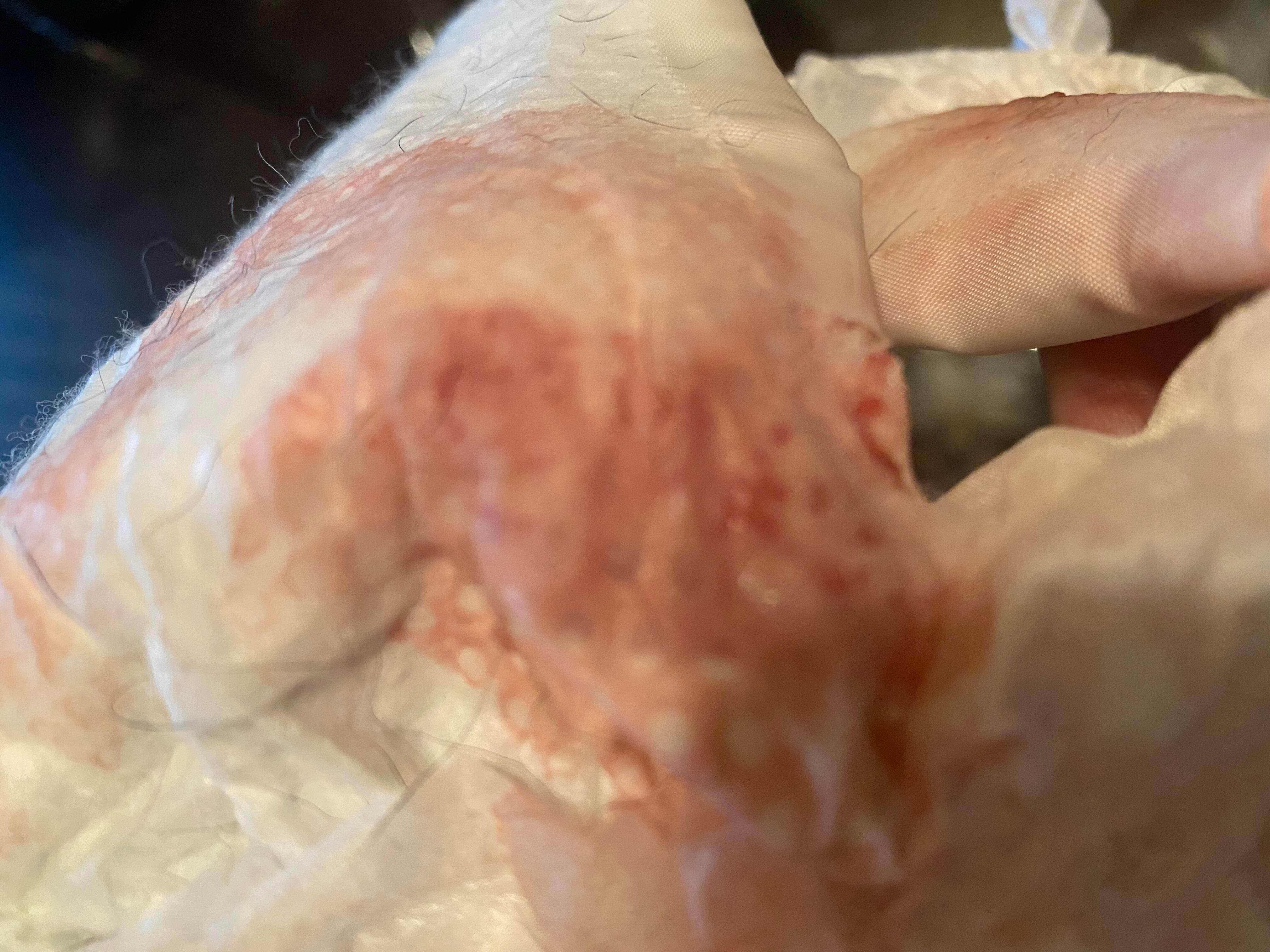 Question details sensitive content