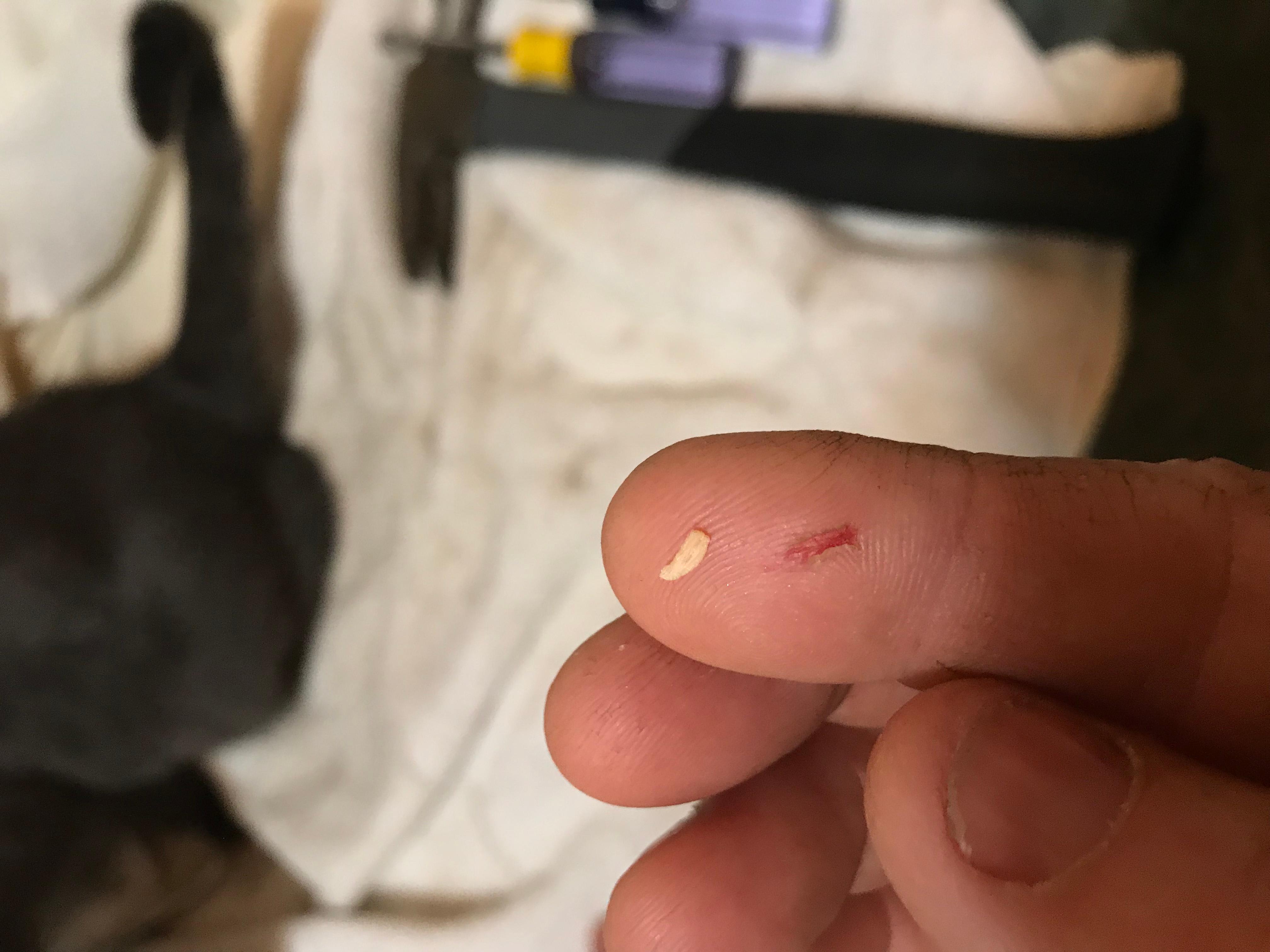 Question details sensitive content