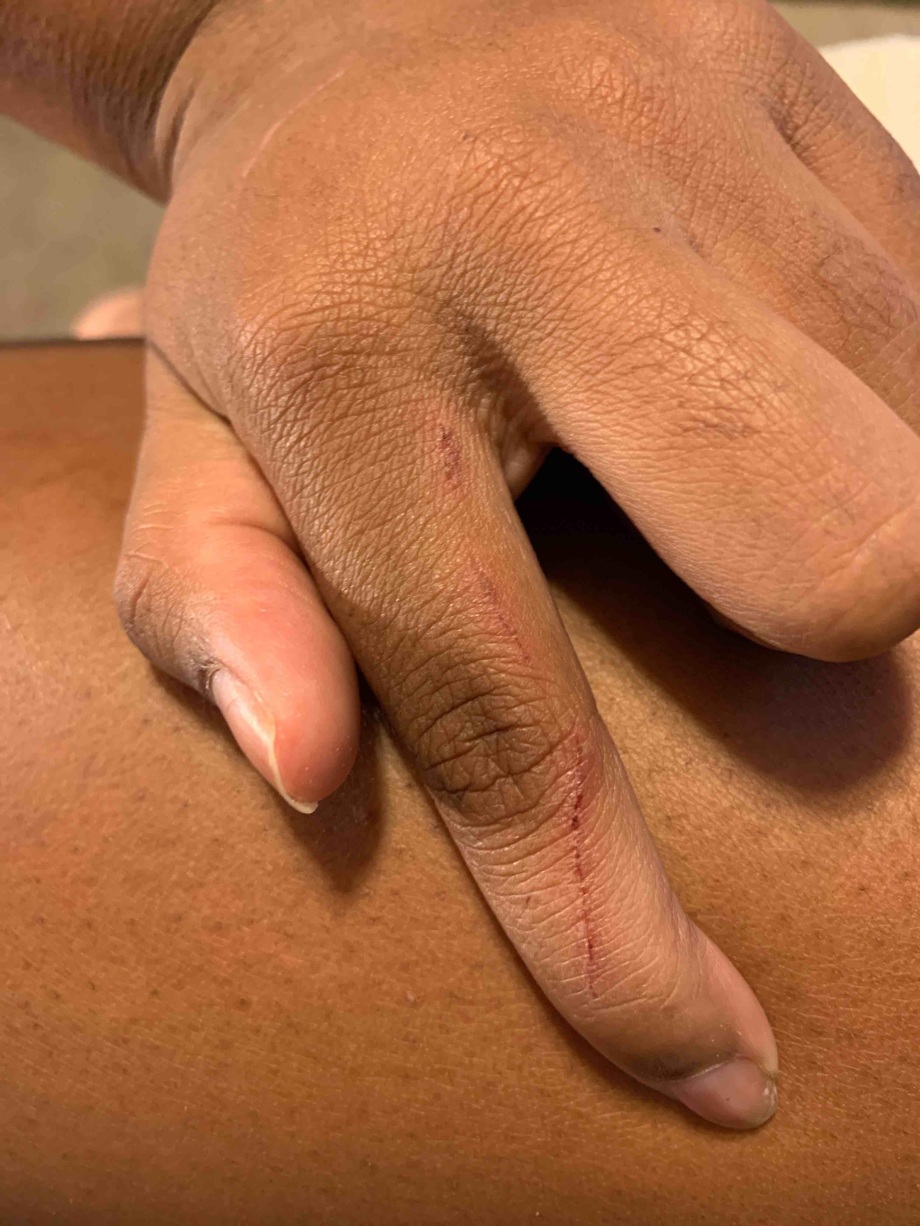 Question details sensitive content