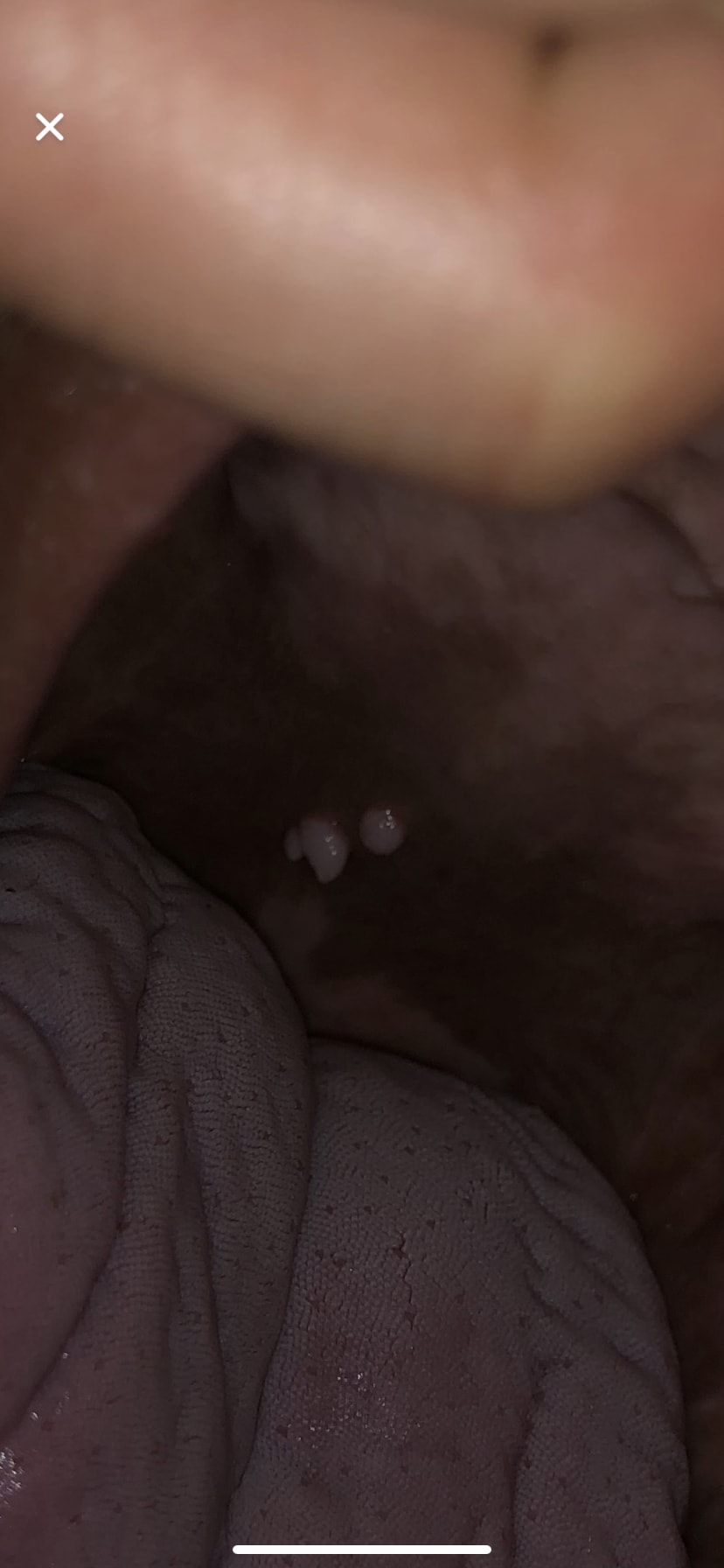 Question details sensitive content