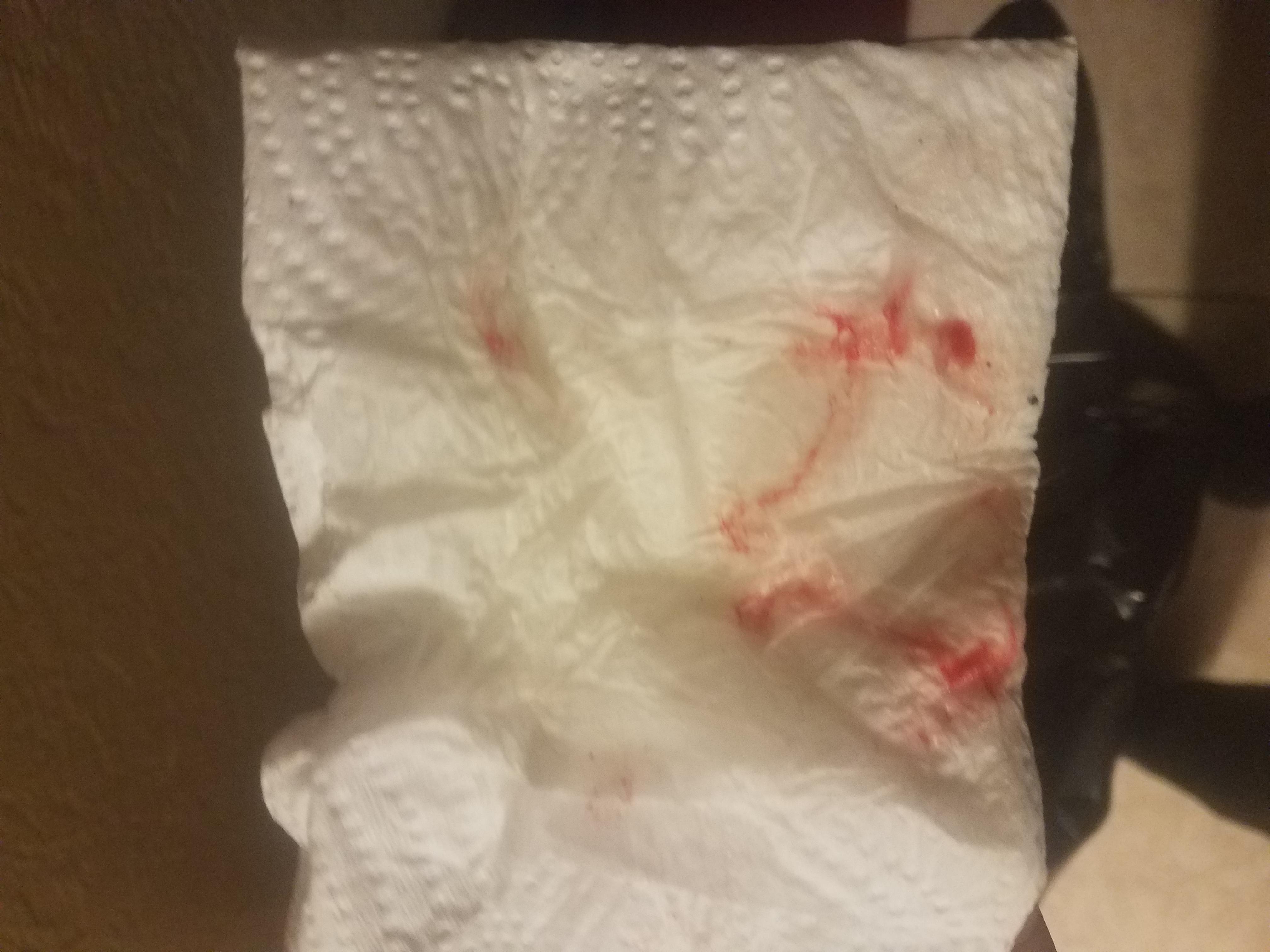 Question details sensitive content