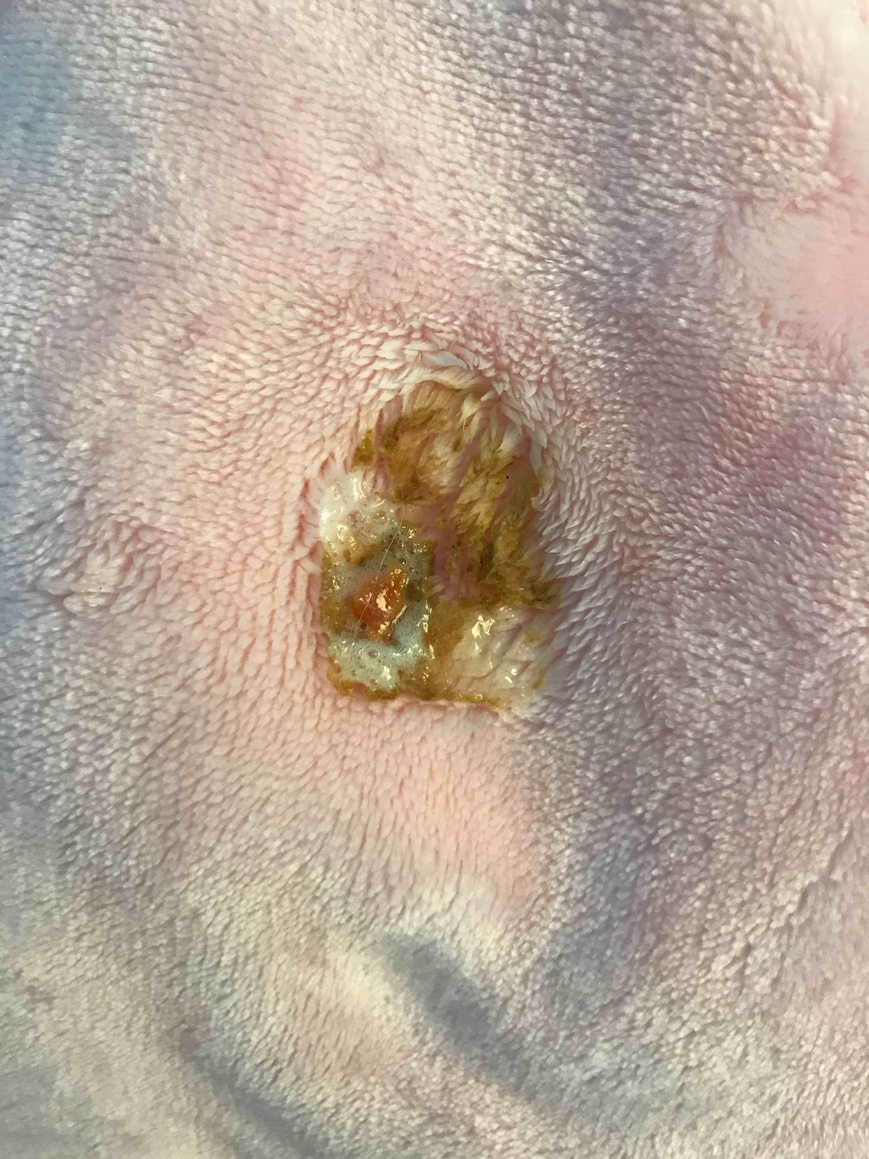 Question details sensitive content