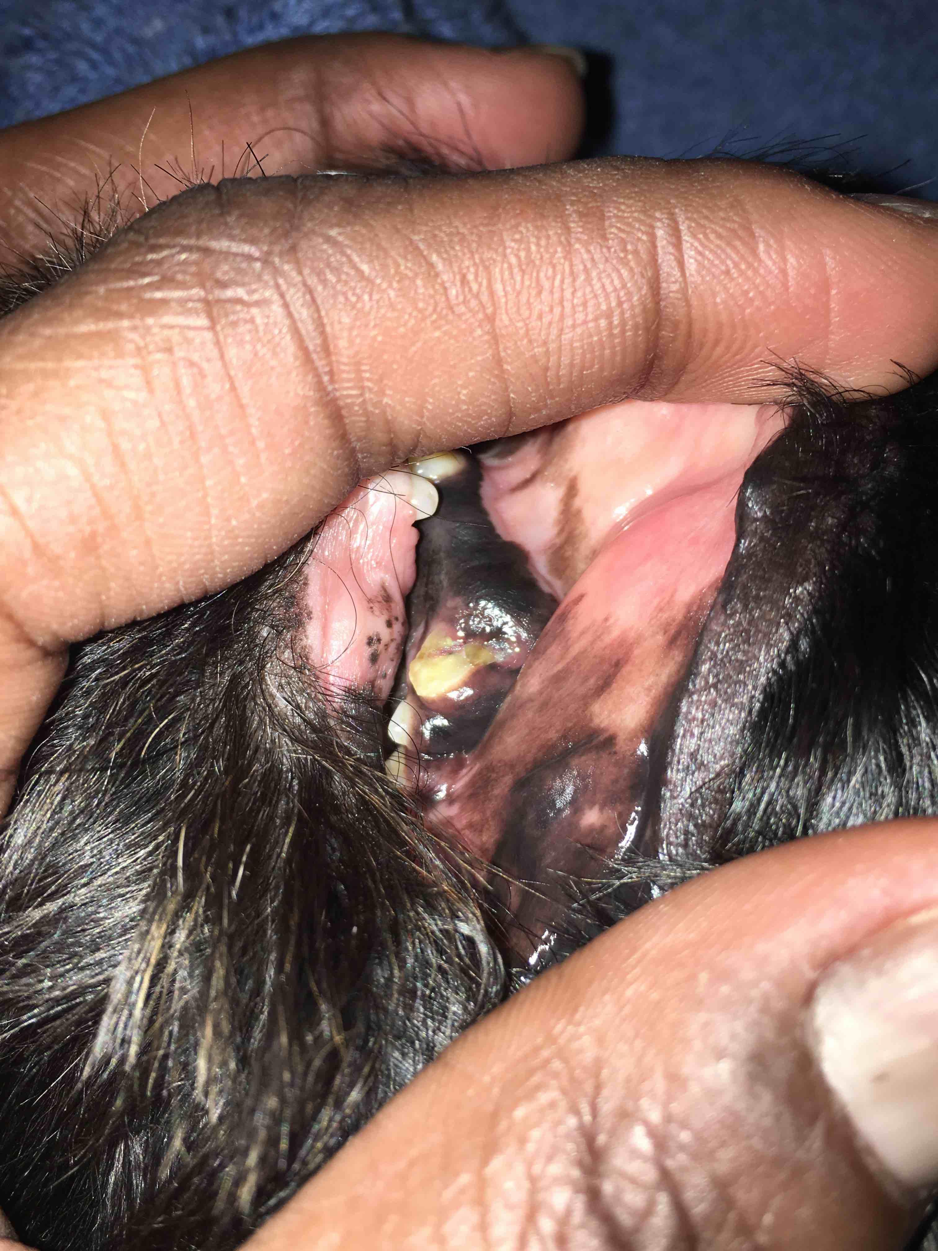 Question details sensitive content