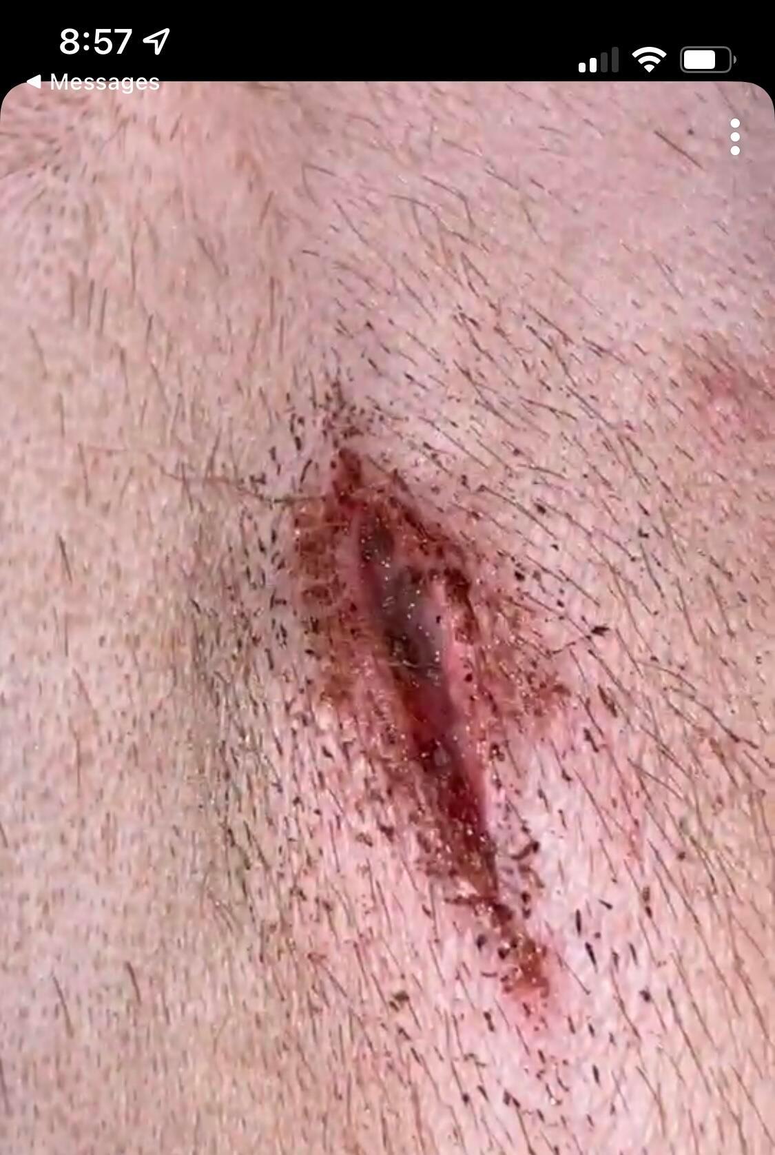 Question details sensitive content