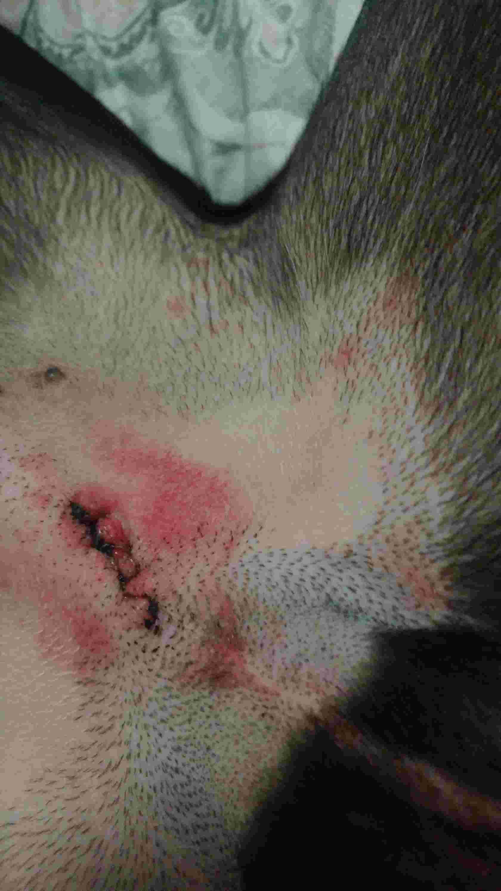 Question details sensitive content