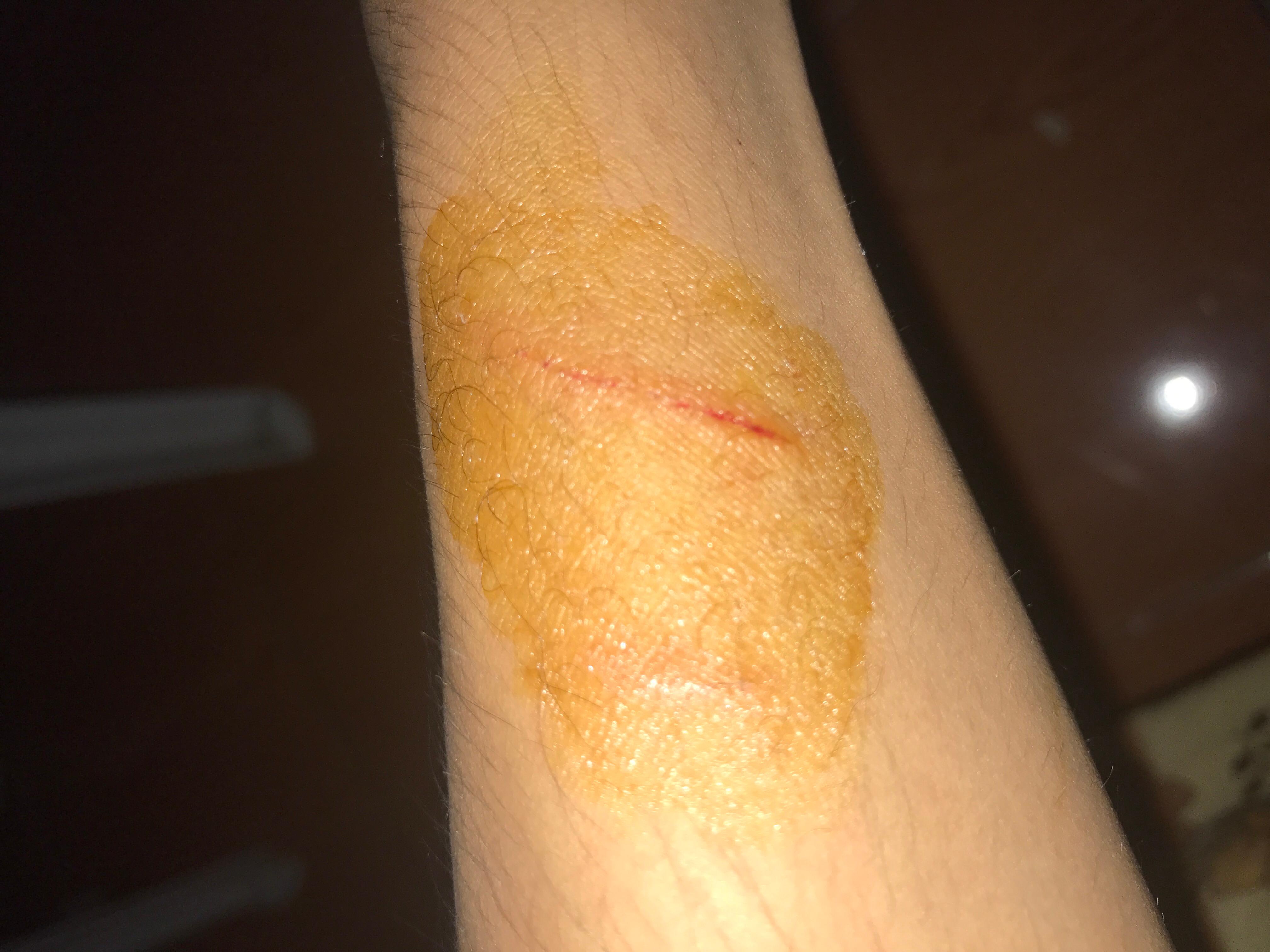 Question details sensitive content