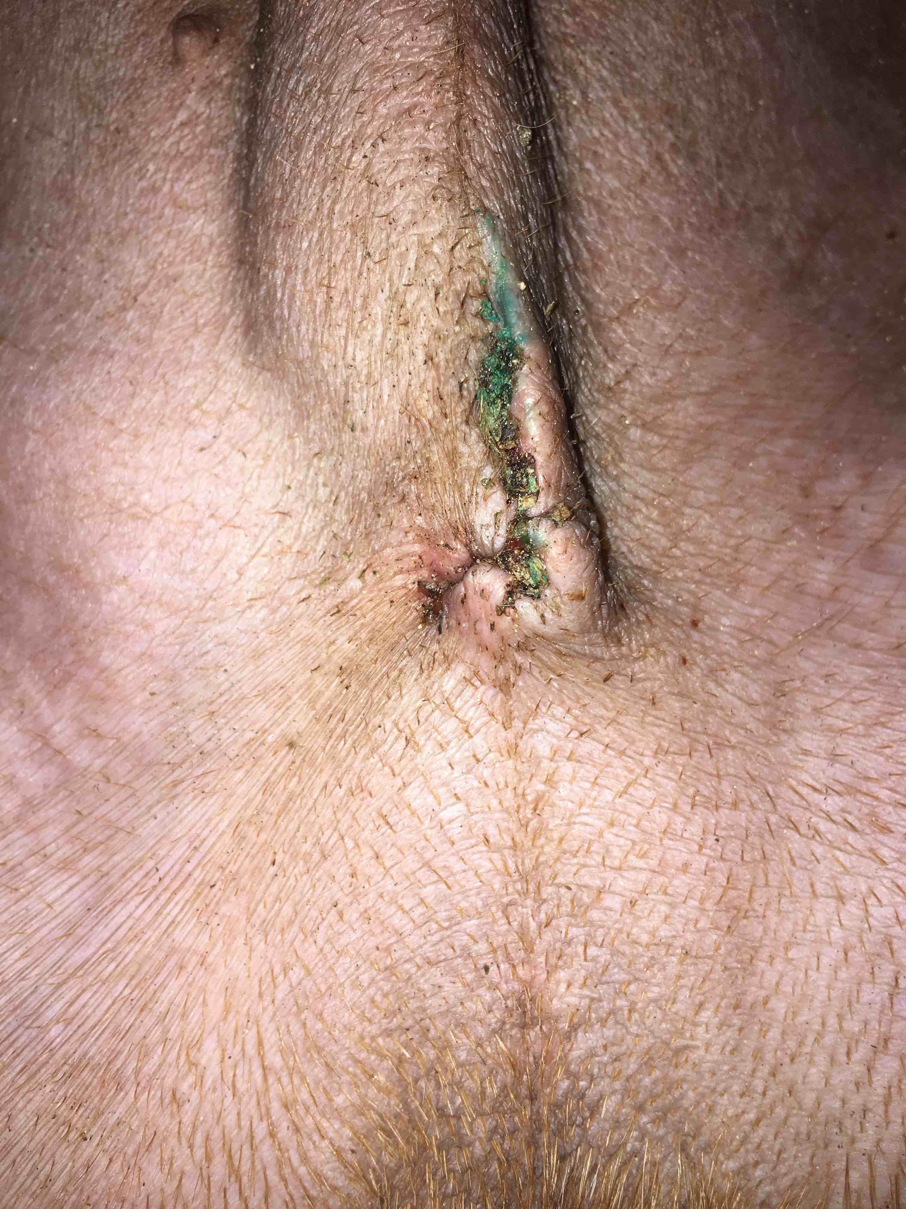 Question details sensitive content