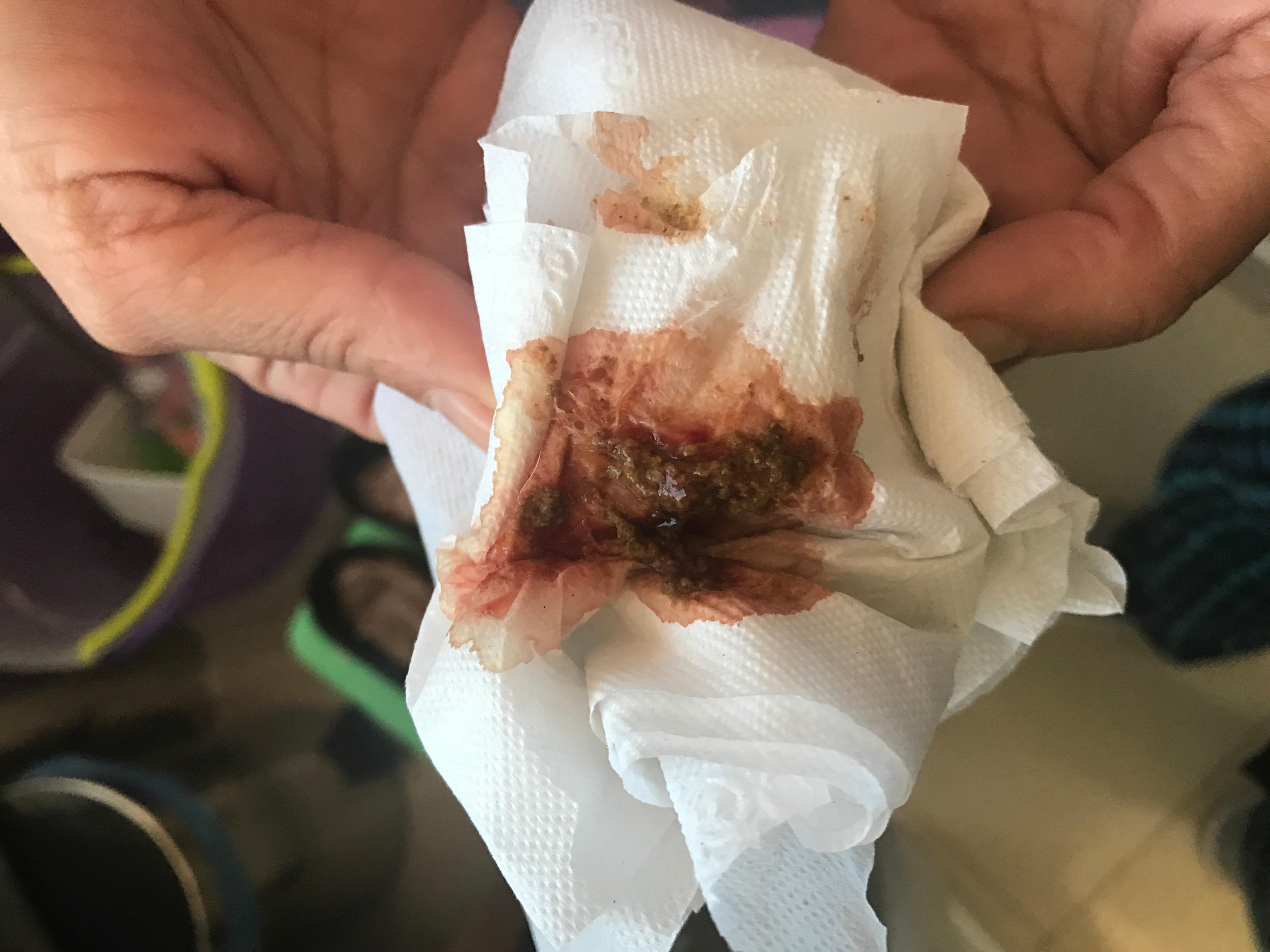 Question details sensitive content