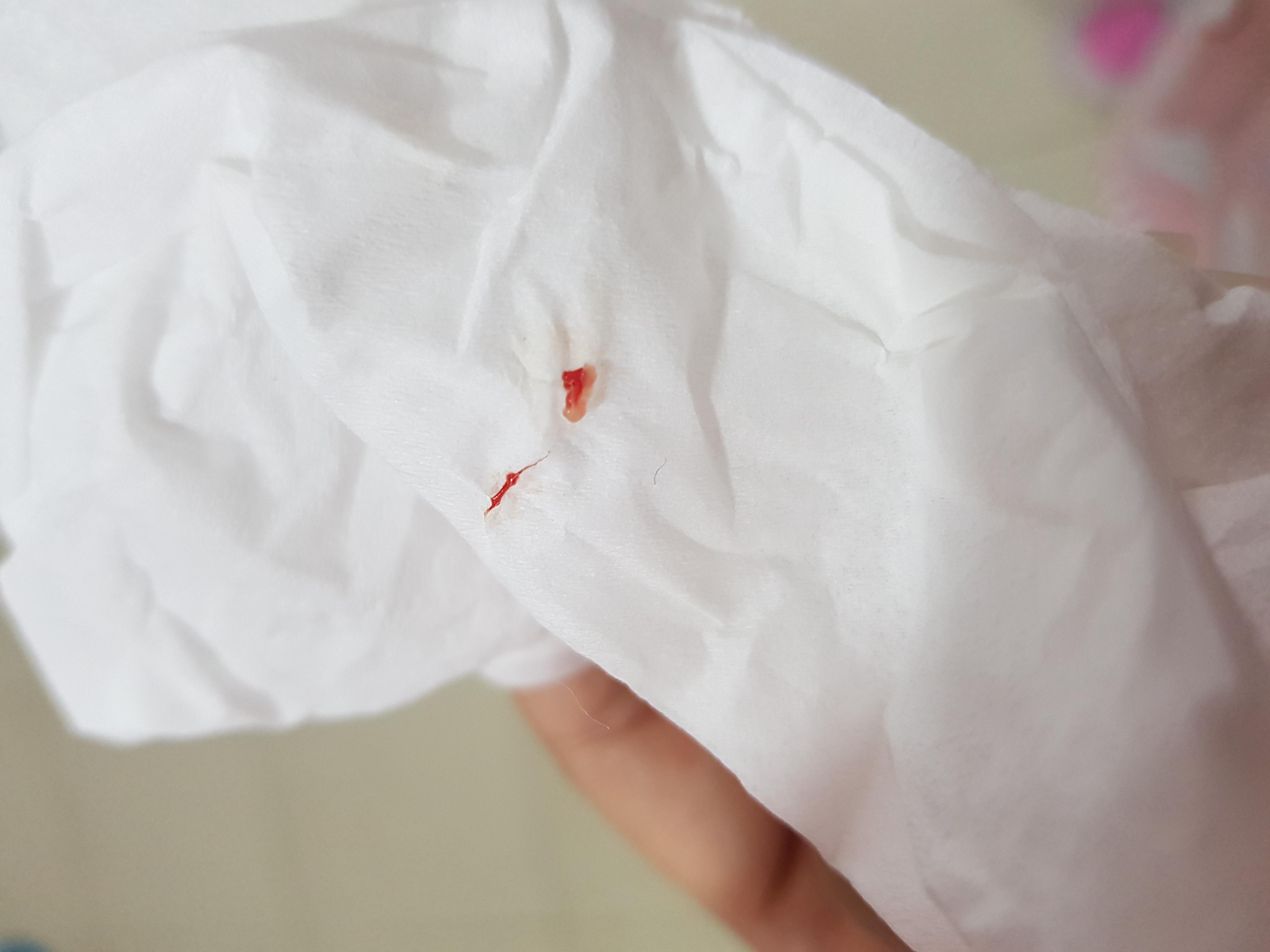 Question details sensitive content