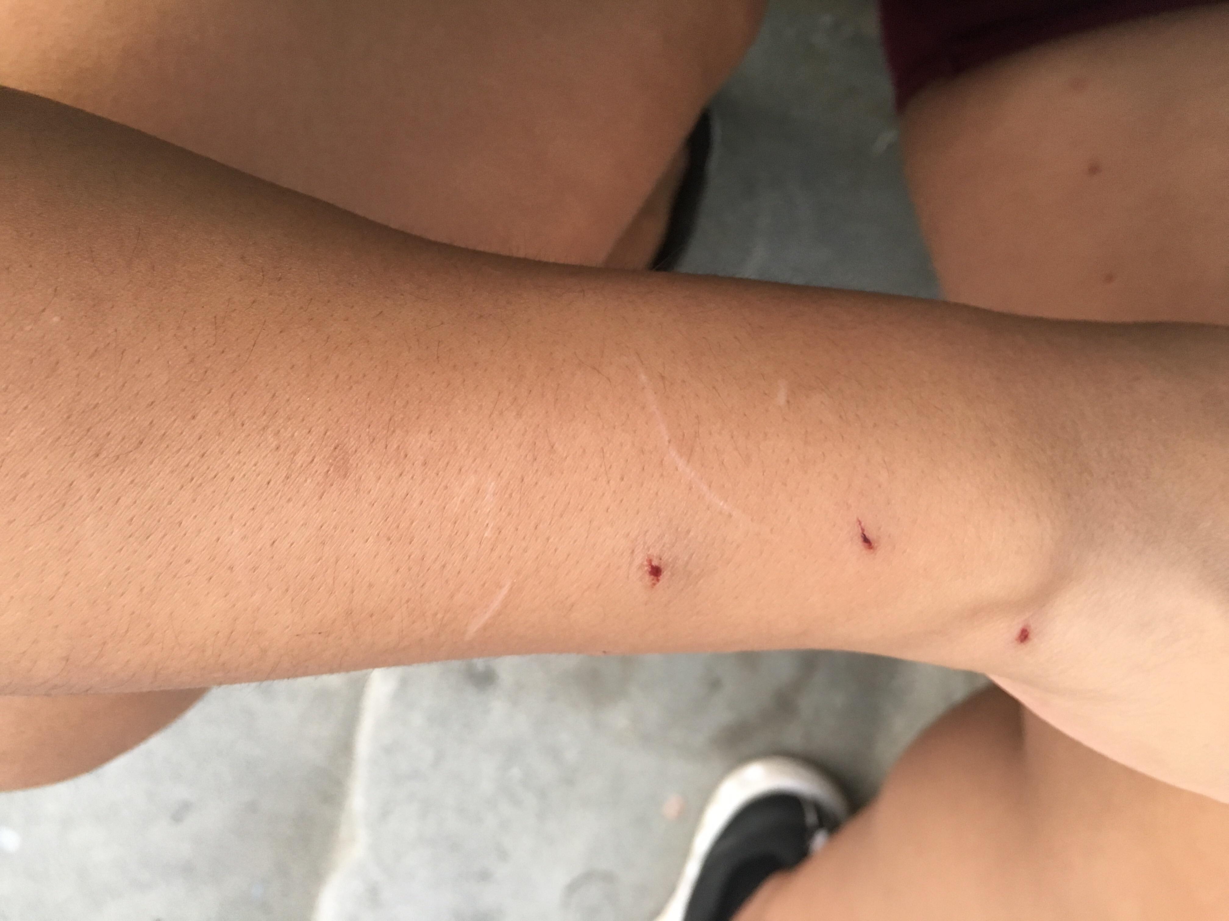 Question details sensitive content