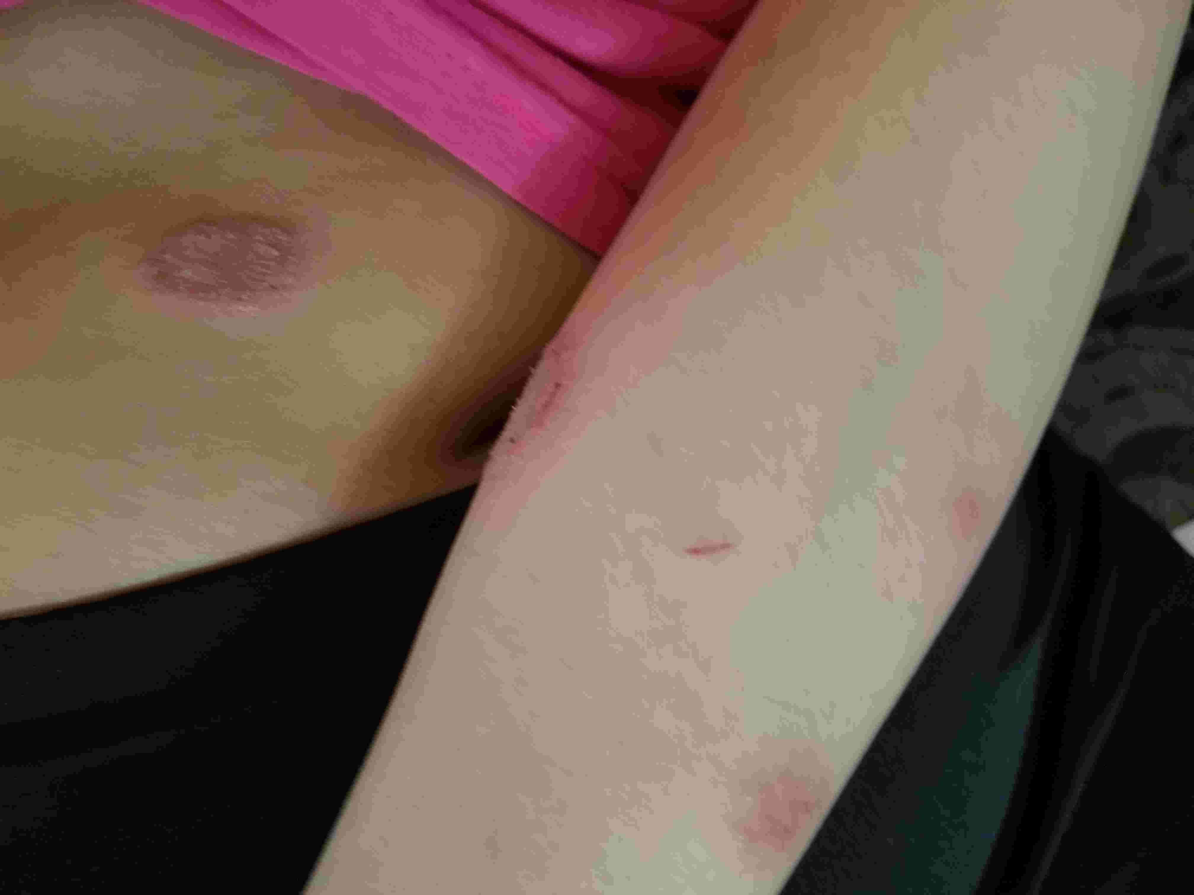 Question details sensitive content