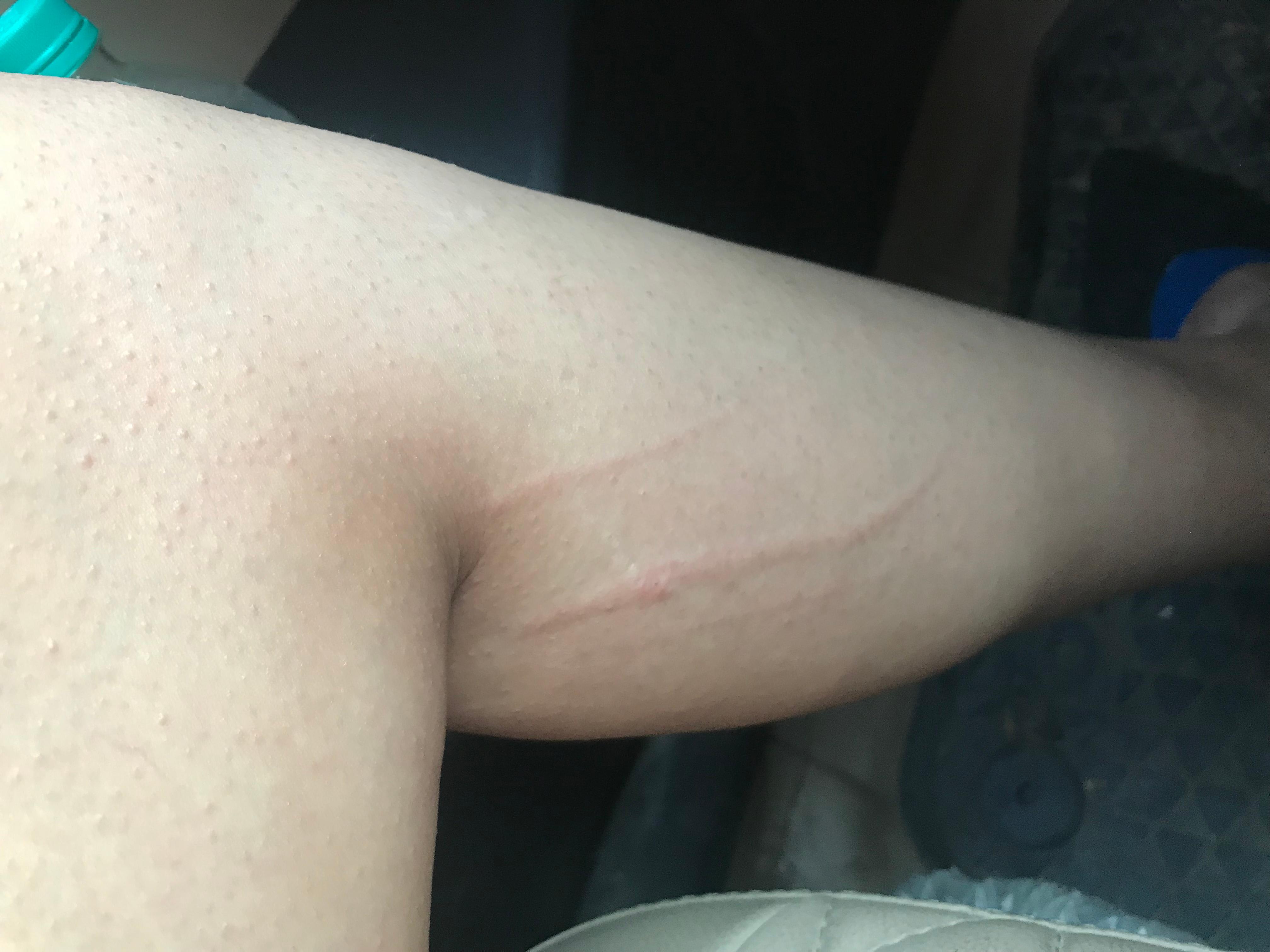 Question details sensitive content