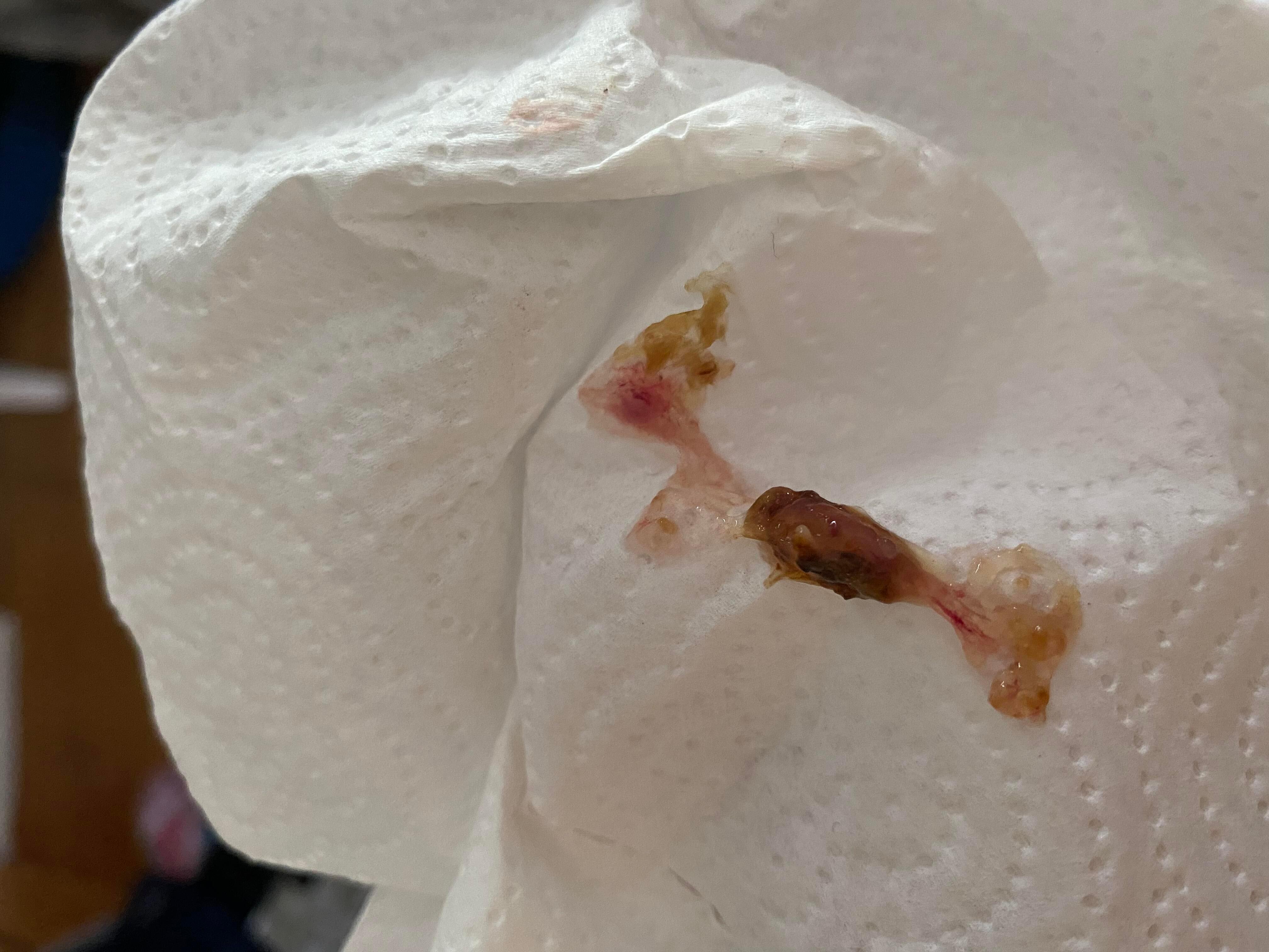 Question details sensitive content