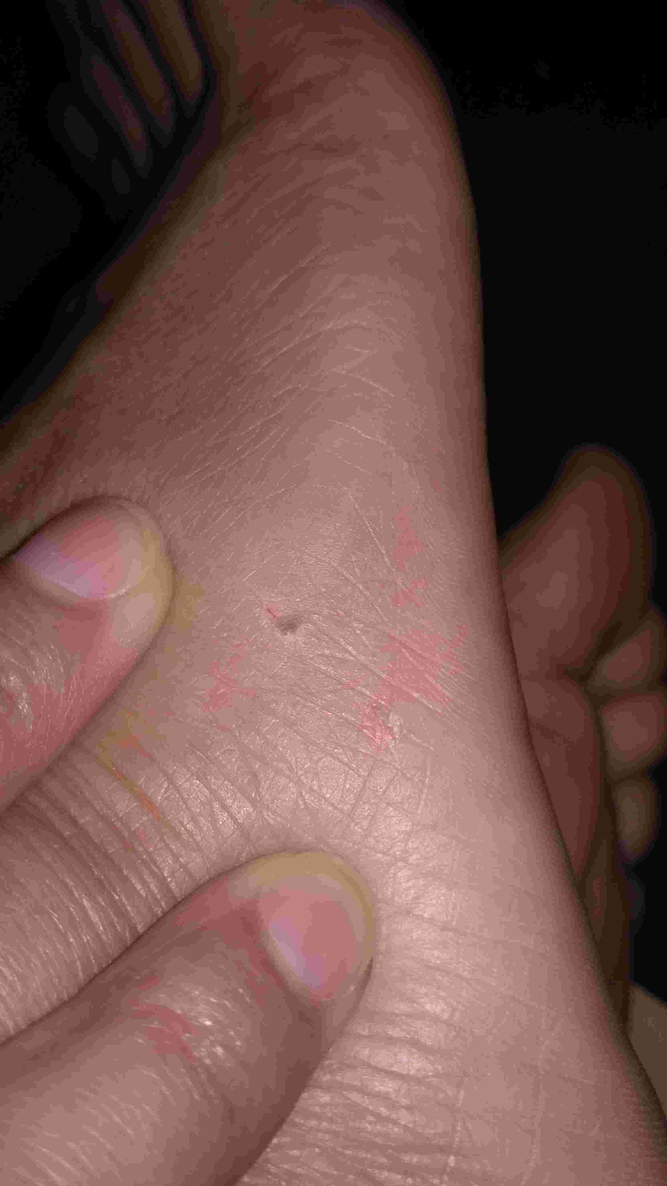 Question details sensitive content