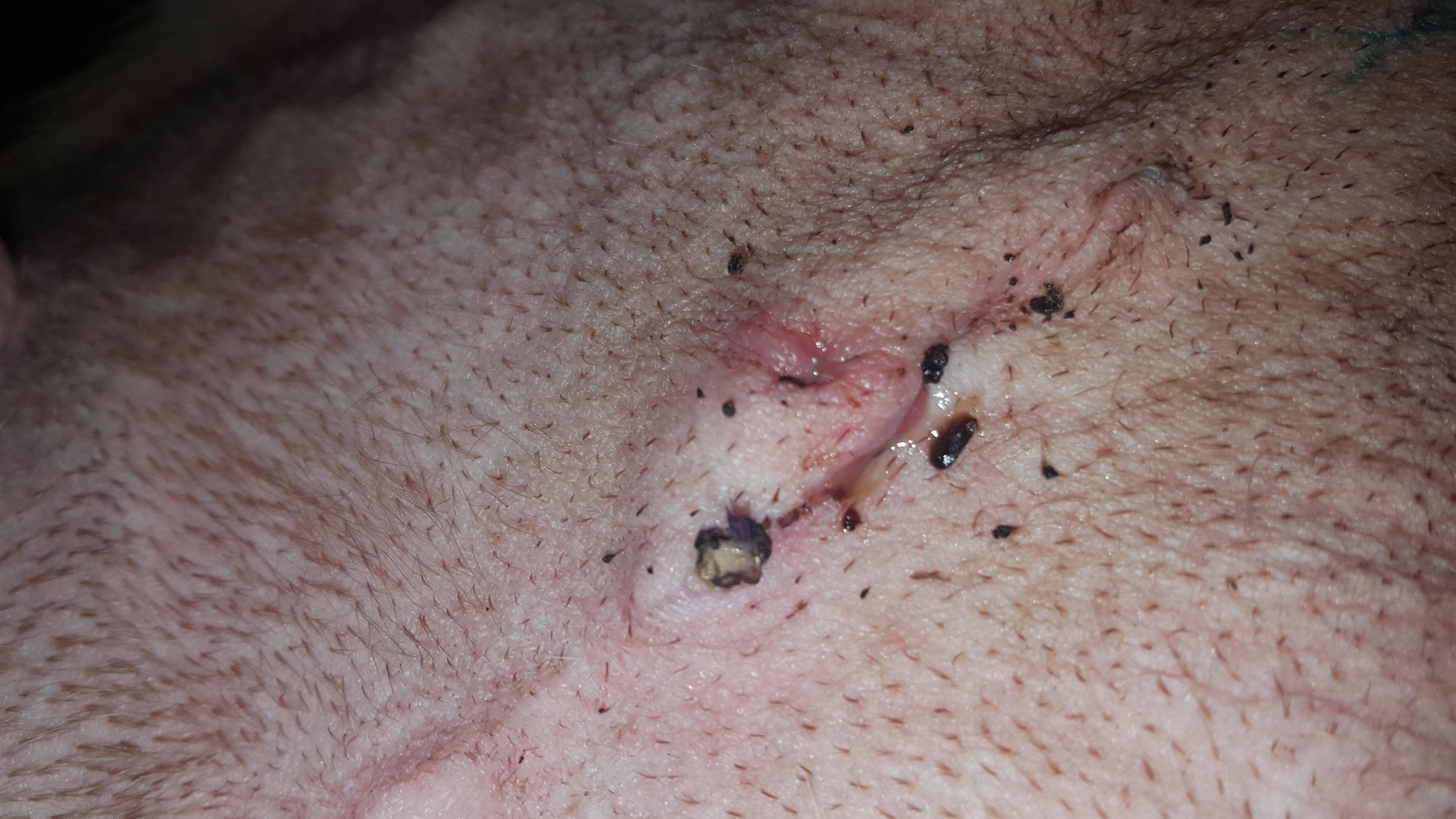 Question details sensitive content