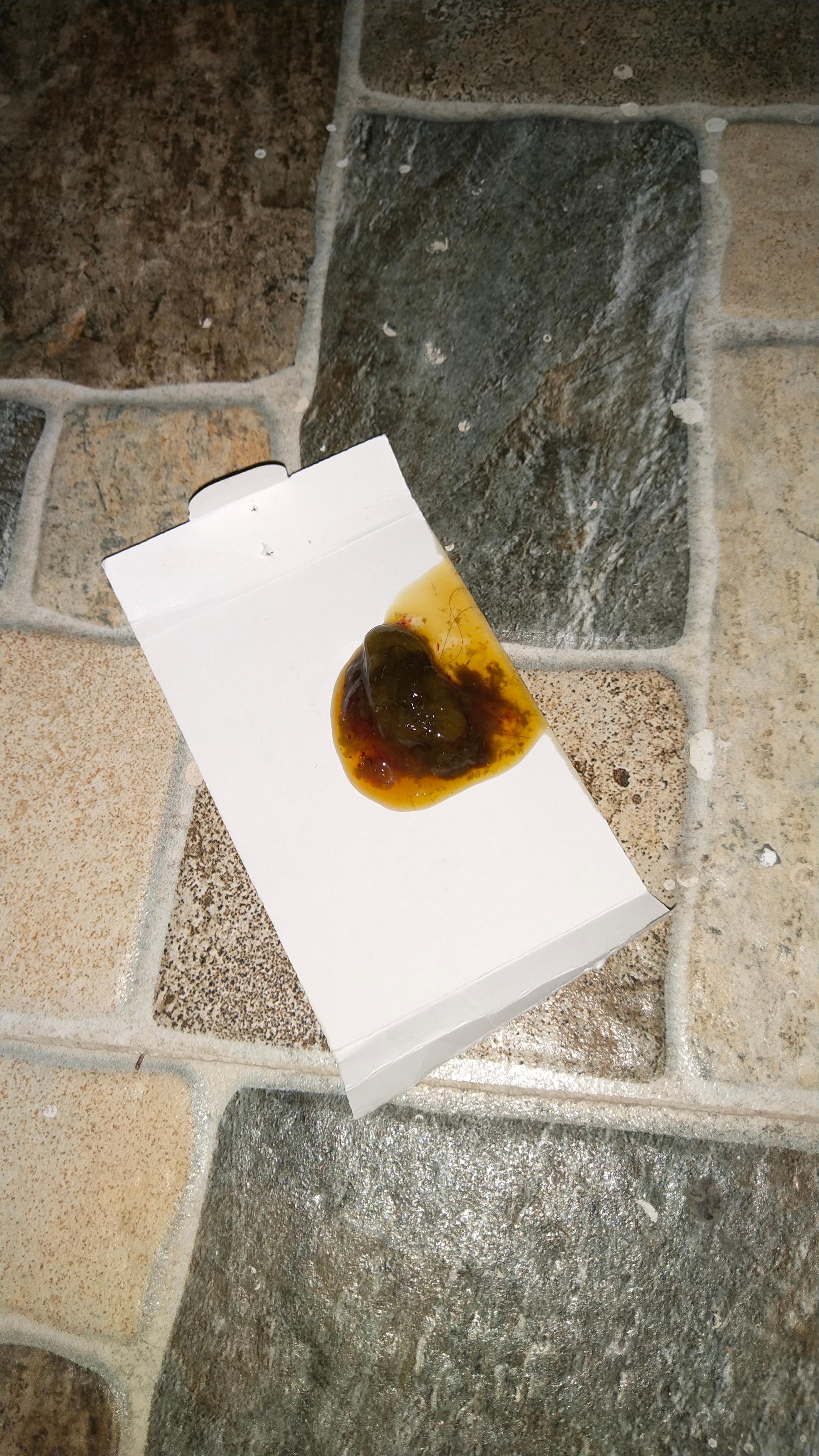 Question details sensitive content