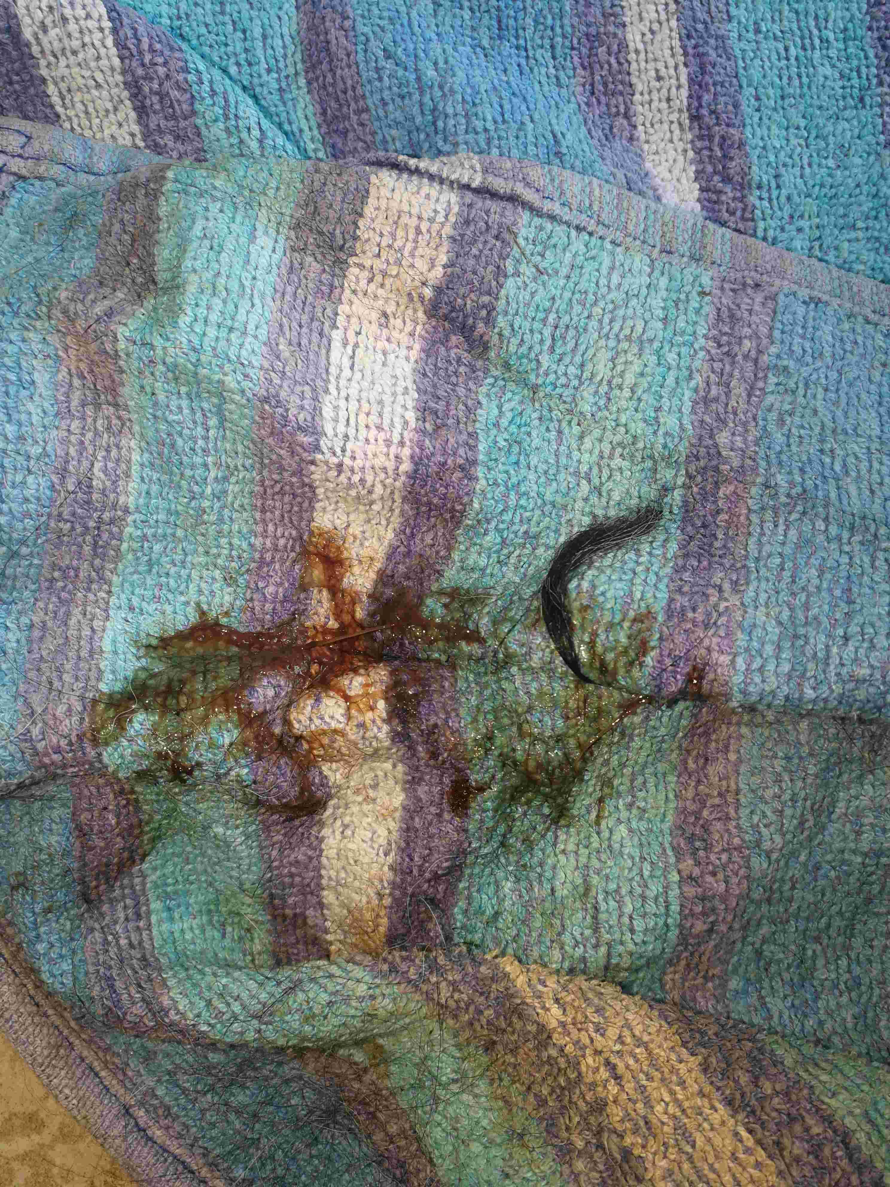 Question details sensitive content