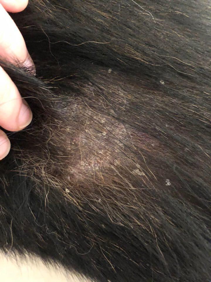 Question details sensitive content