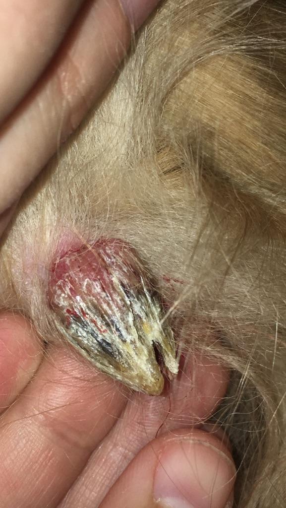 Question details sensitive content