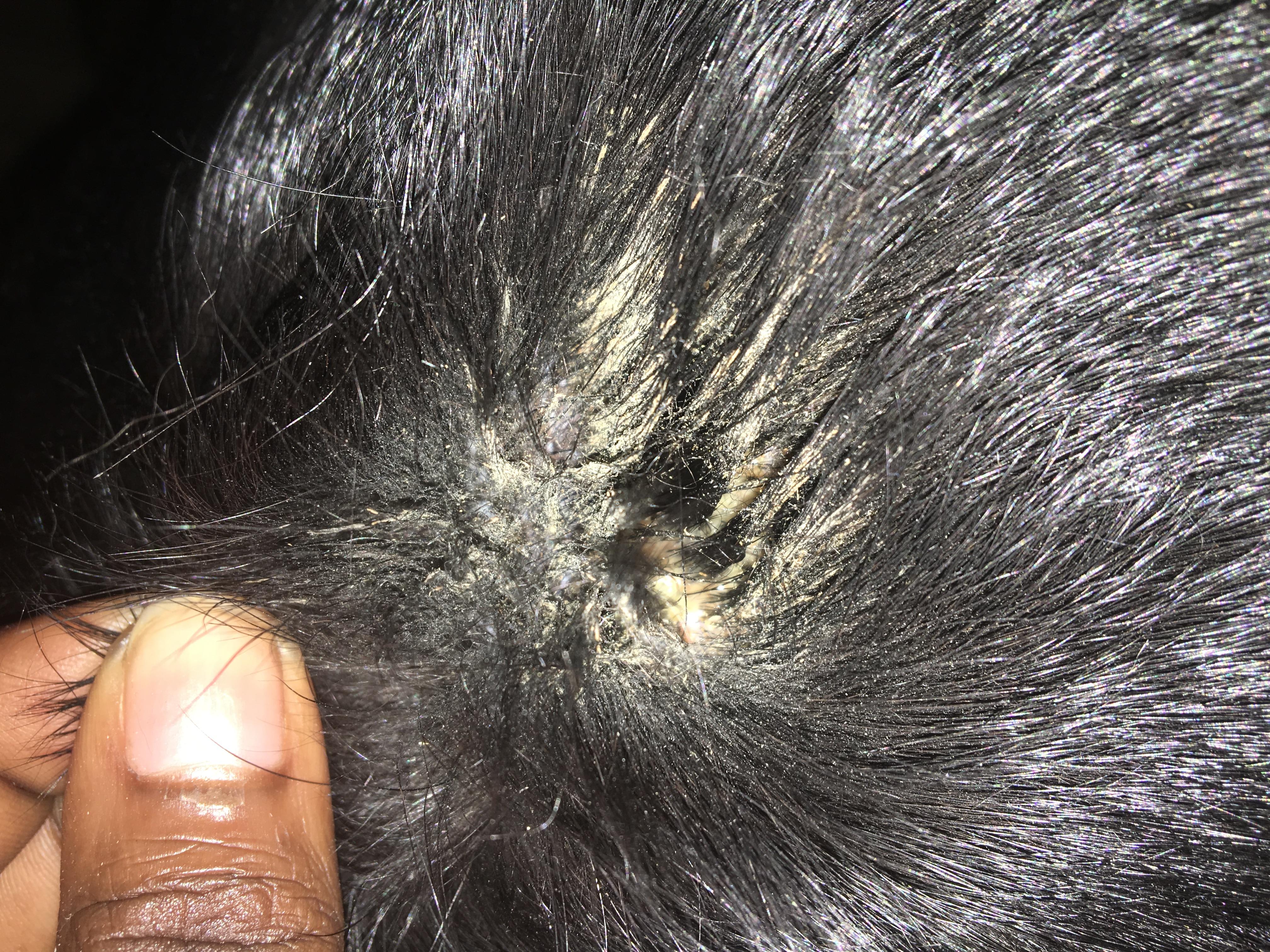 Question details sensitive content