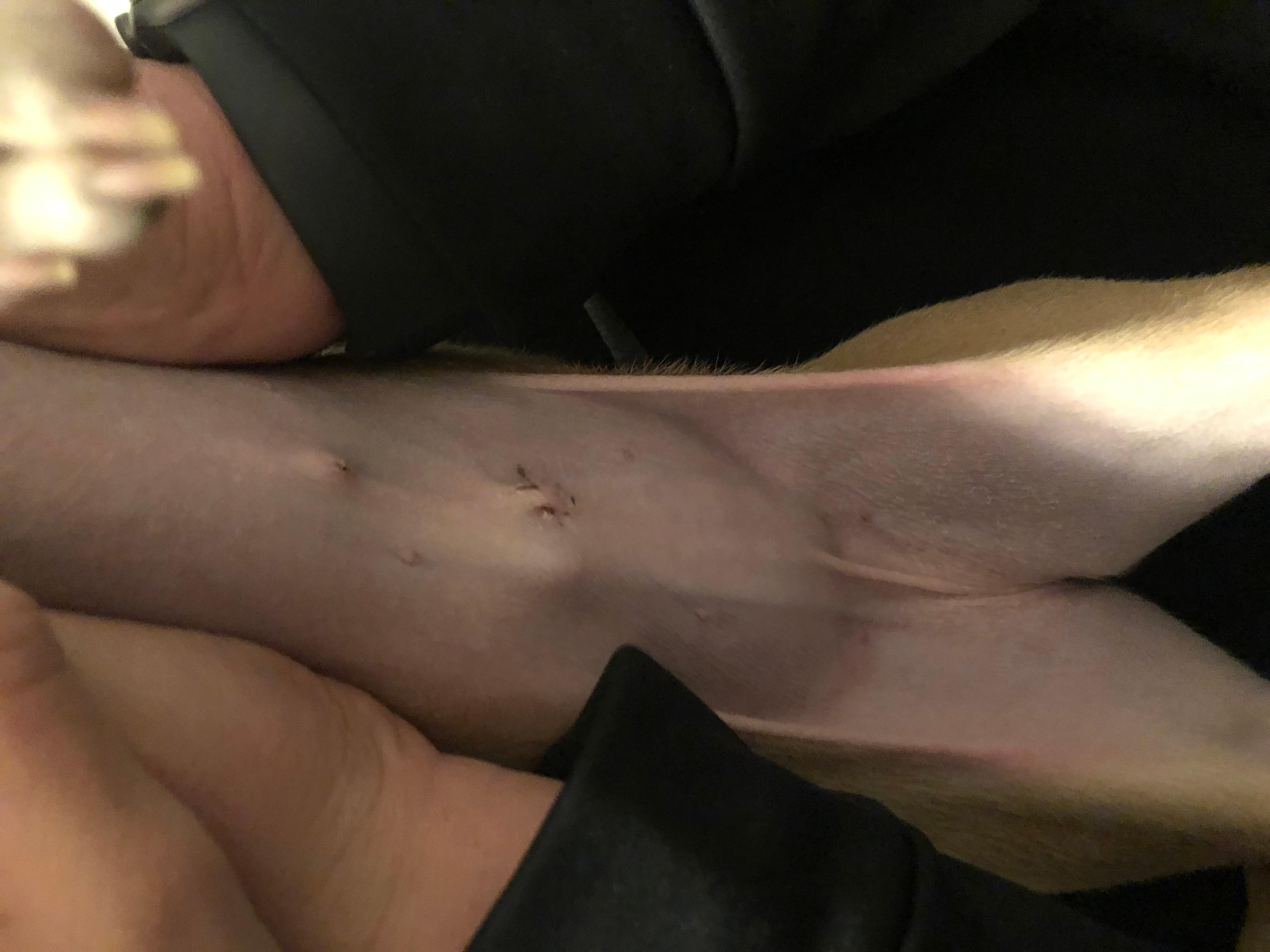 Question details sensitive content