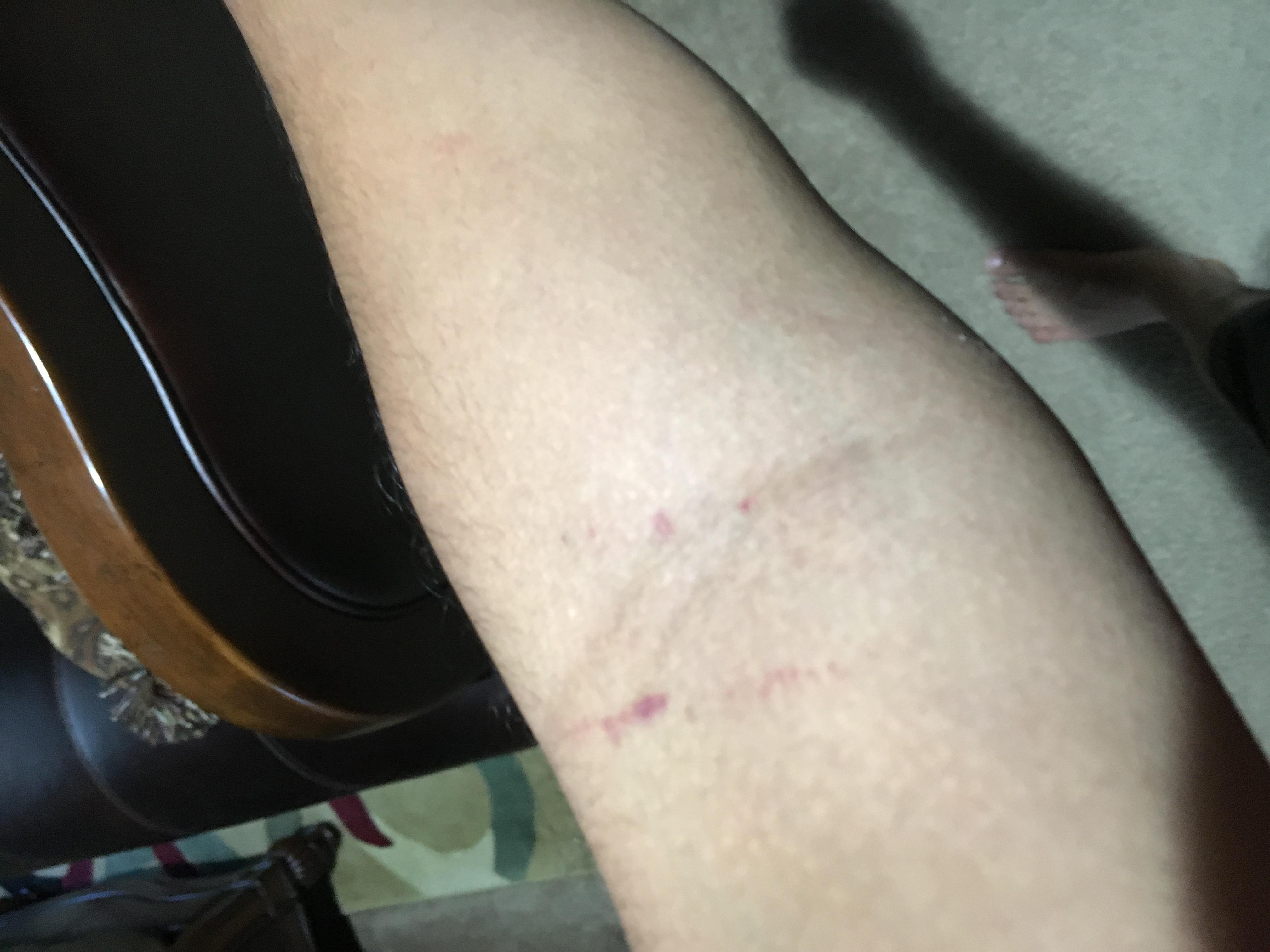 Question details sensitive content