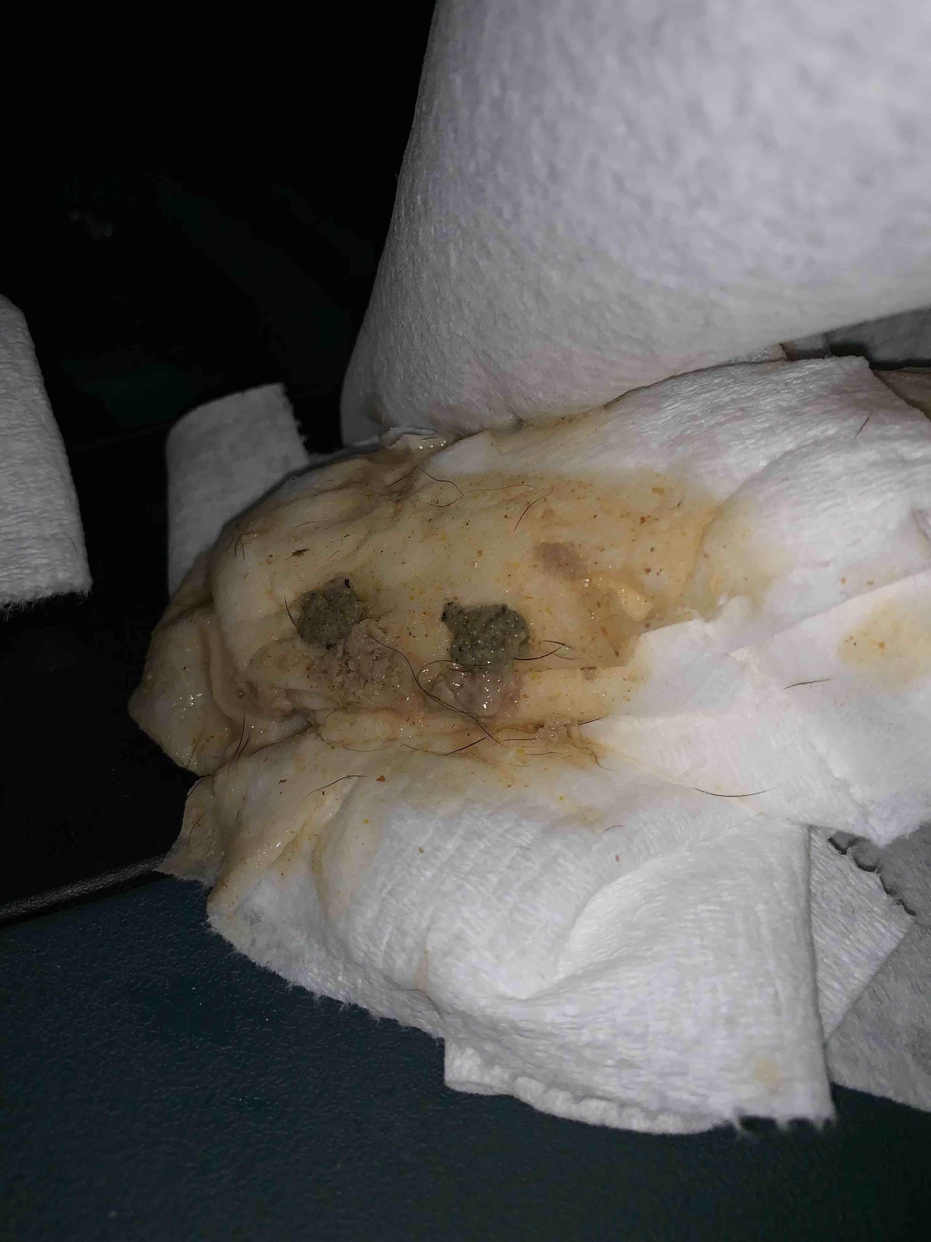 Question details sensitive content