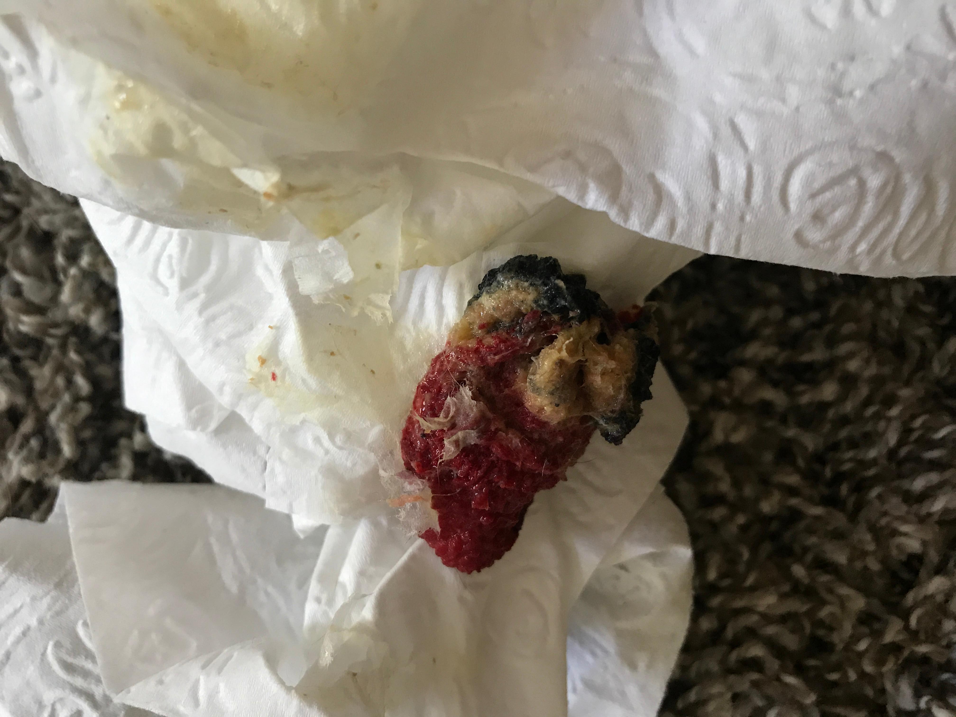 Question details sensitive content