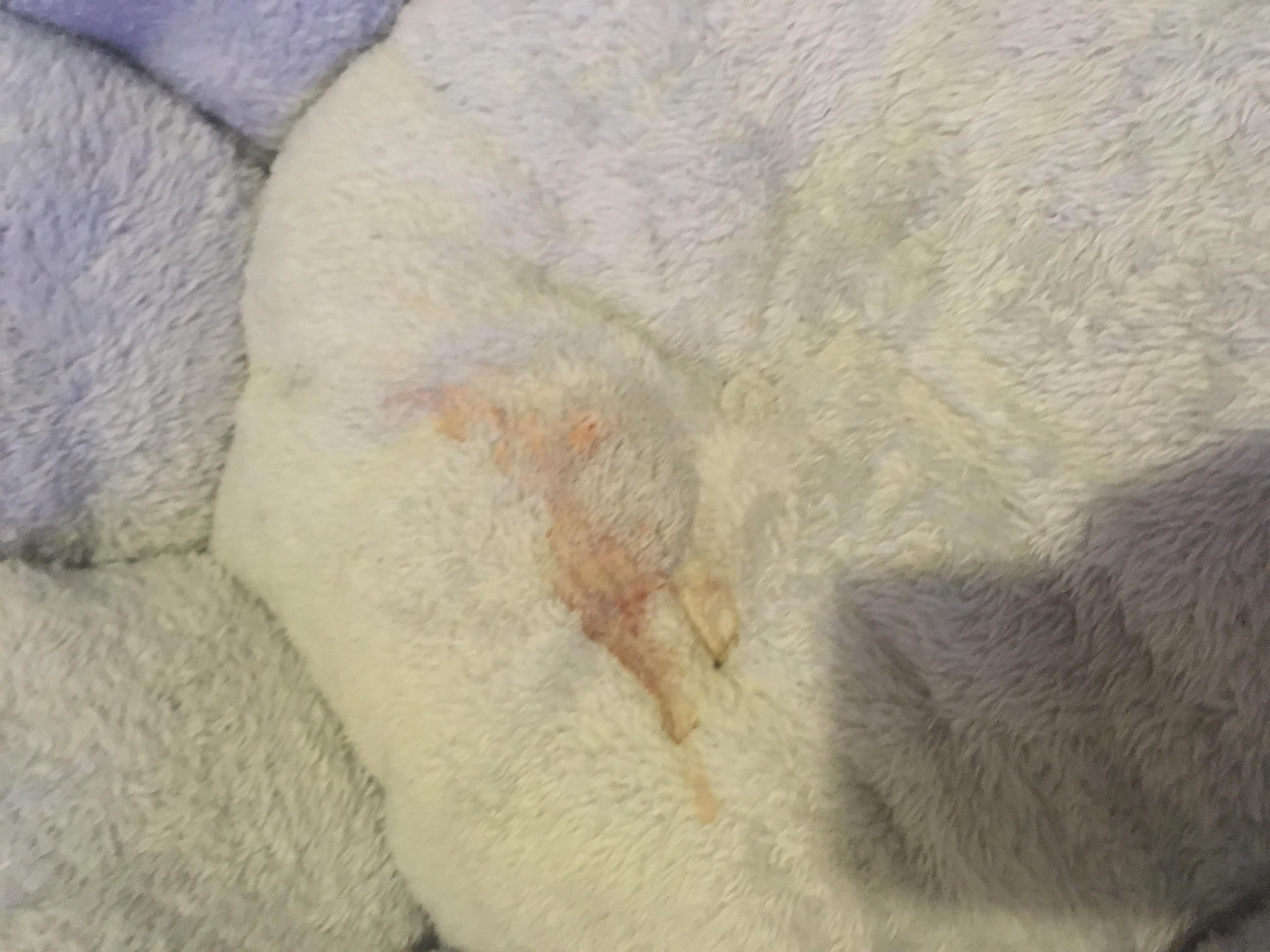 Question details sensitive content