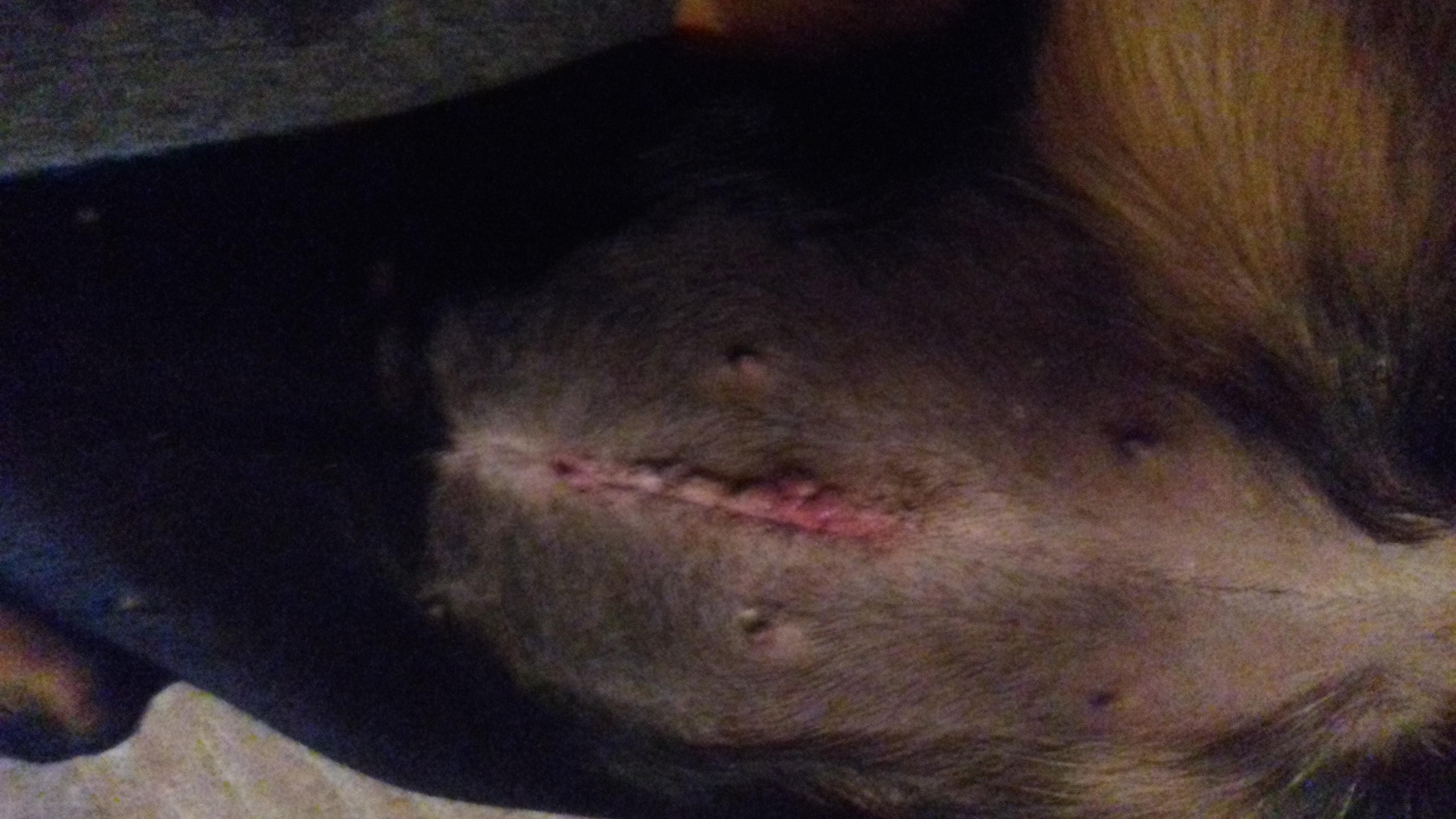 Question details sensitive content