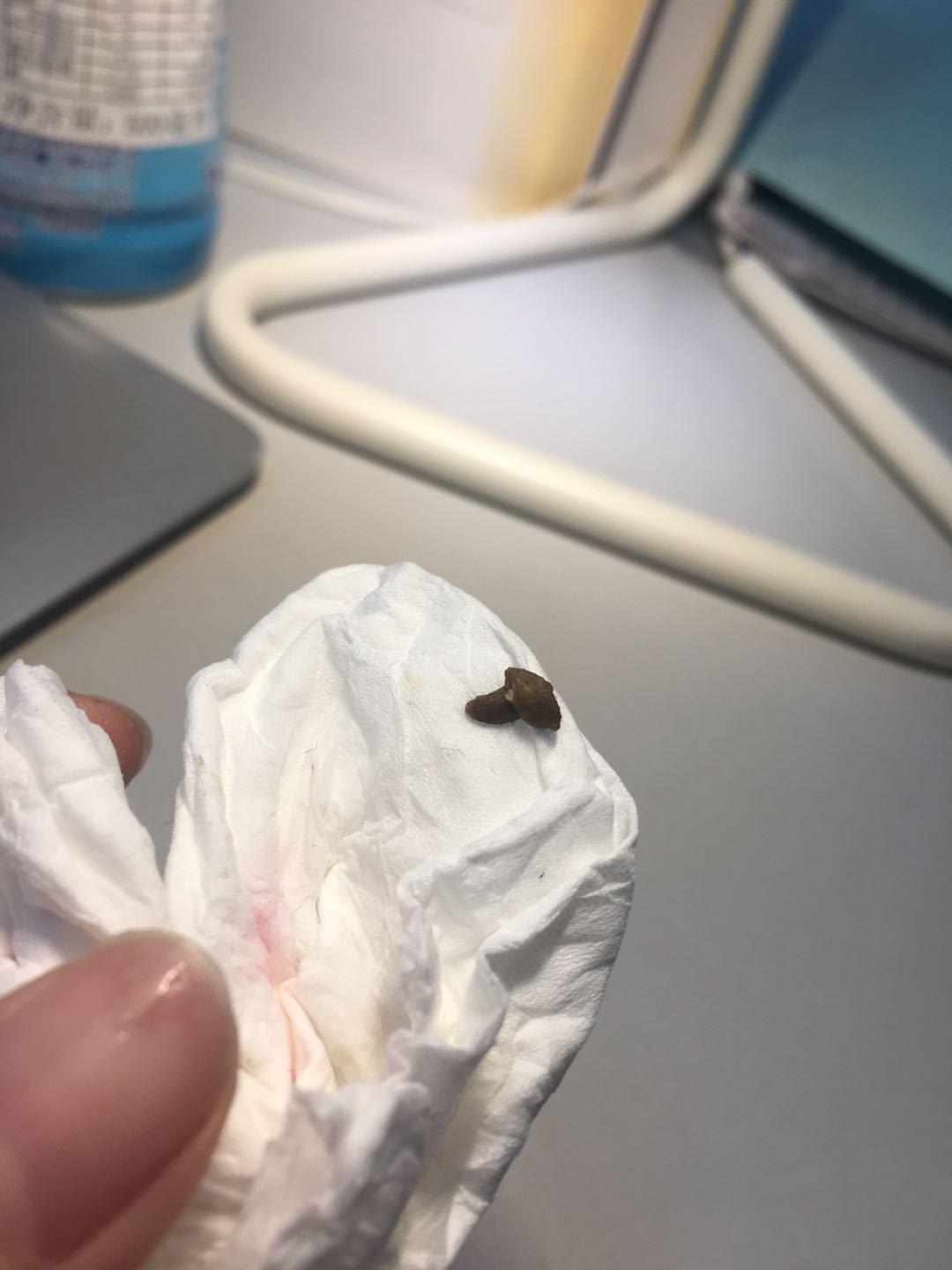 Question details sensitive content