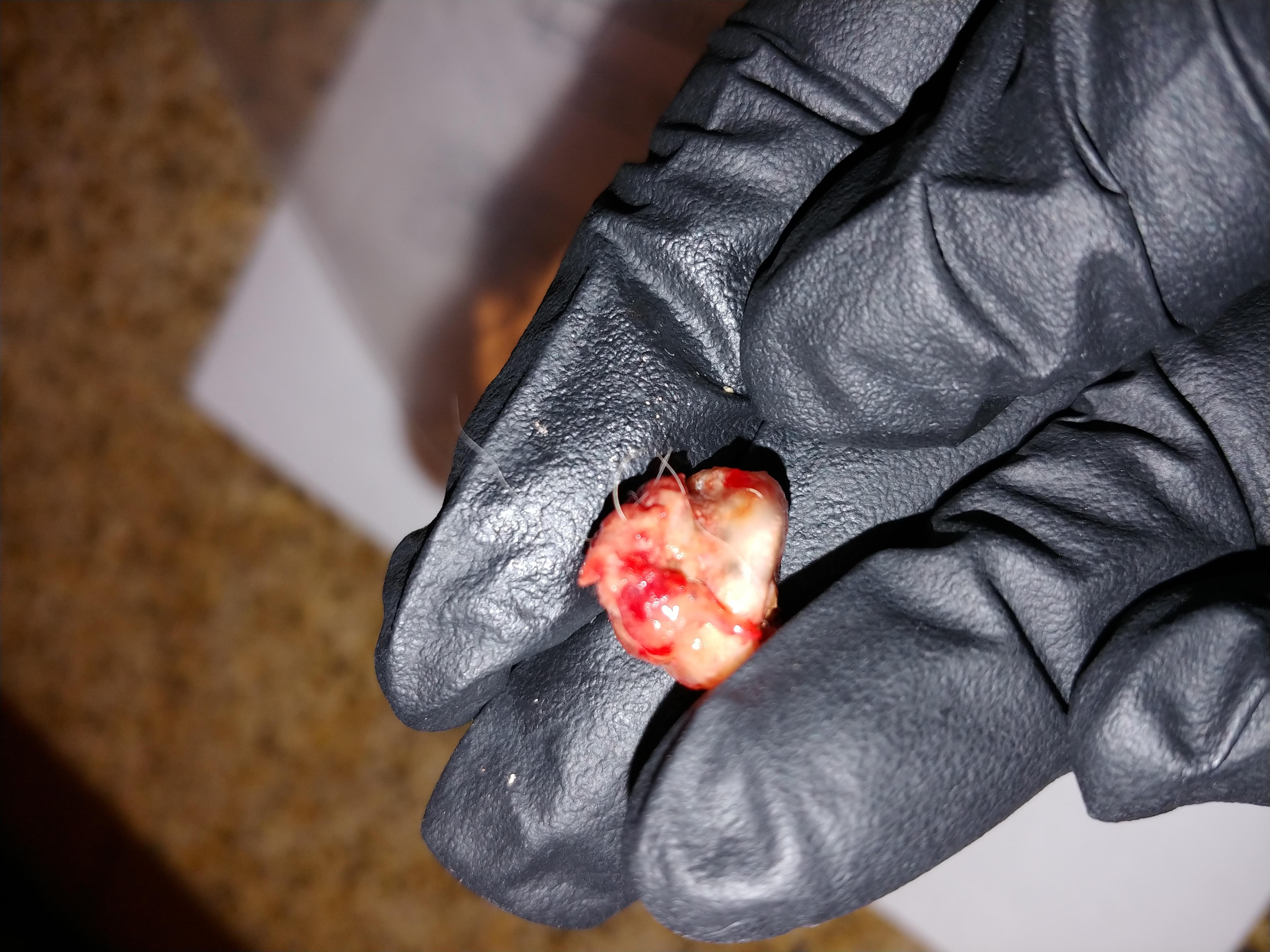 Question details sensitive content