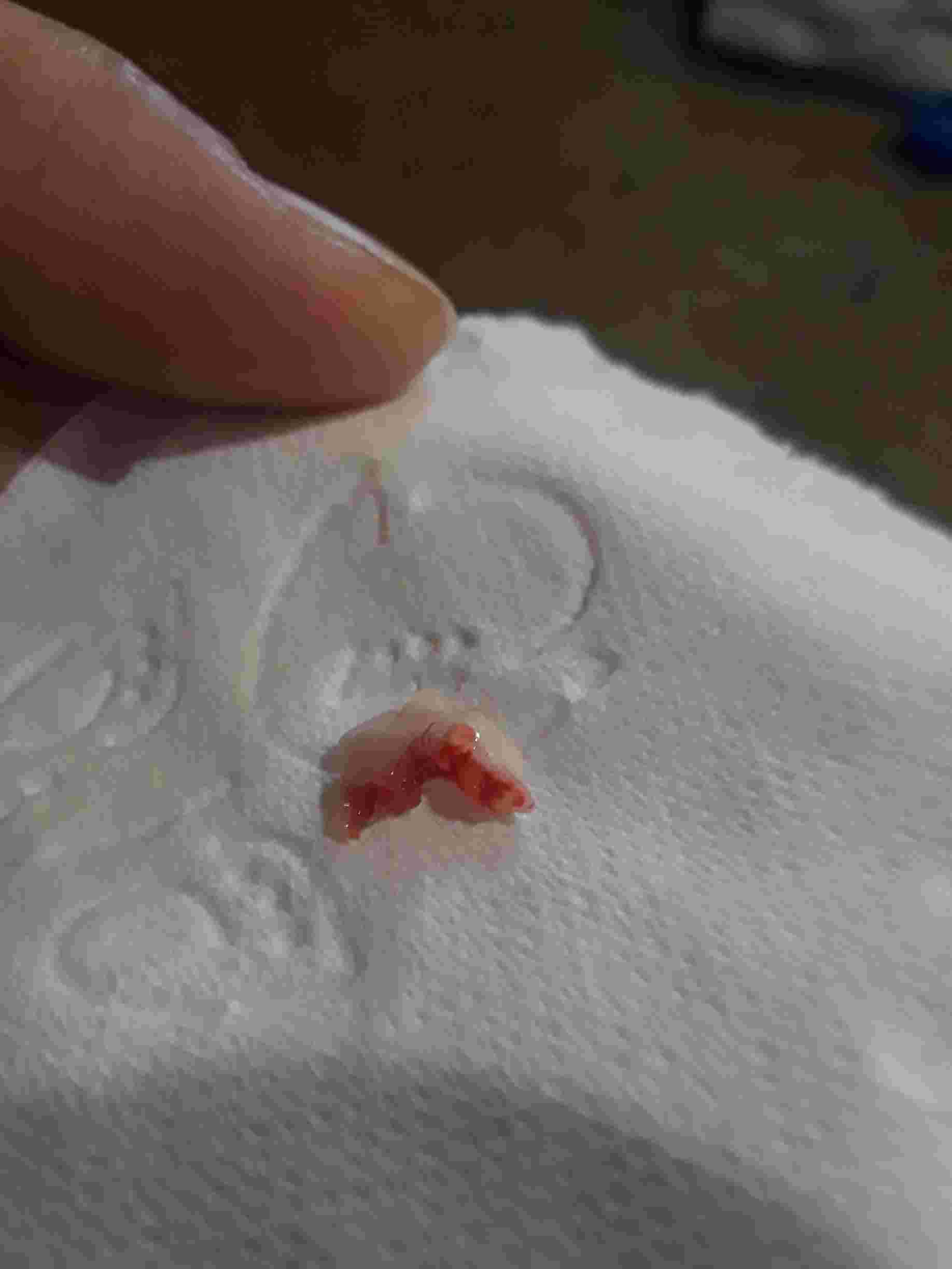 Question details sensitive content