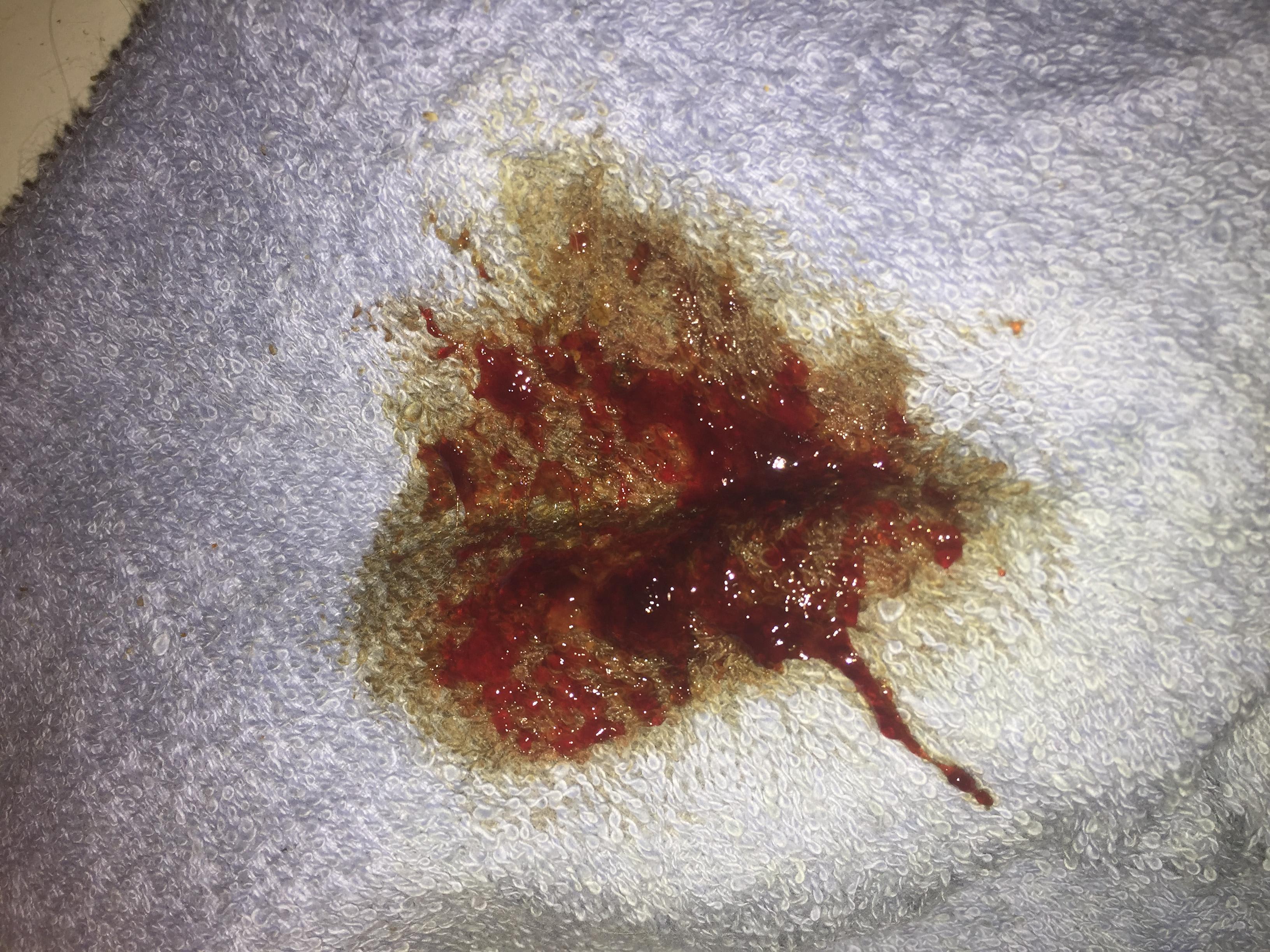 Question details sensitive content