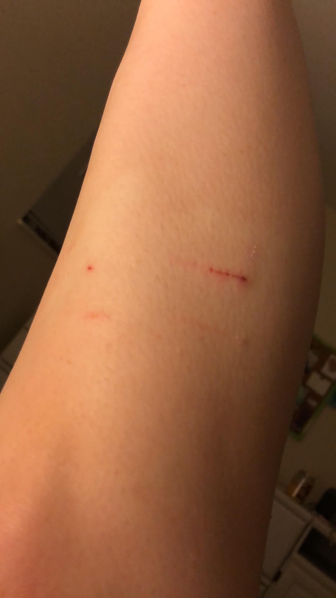 Question details sensitive content