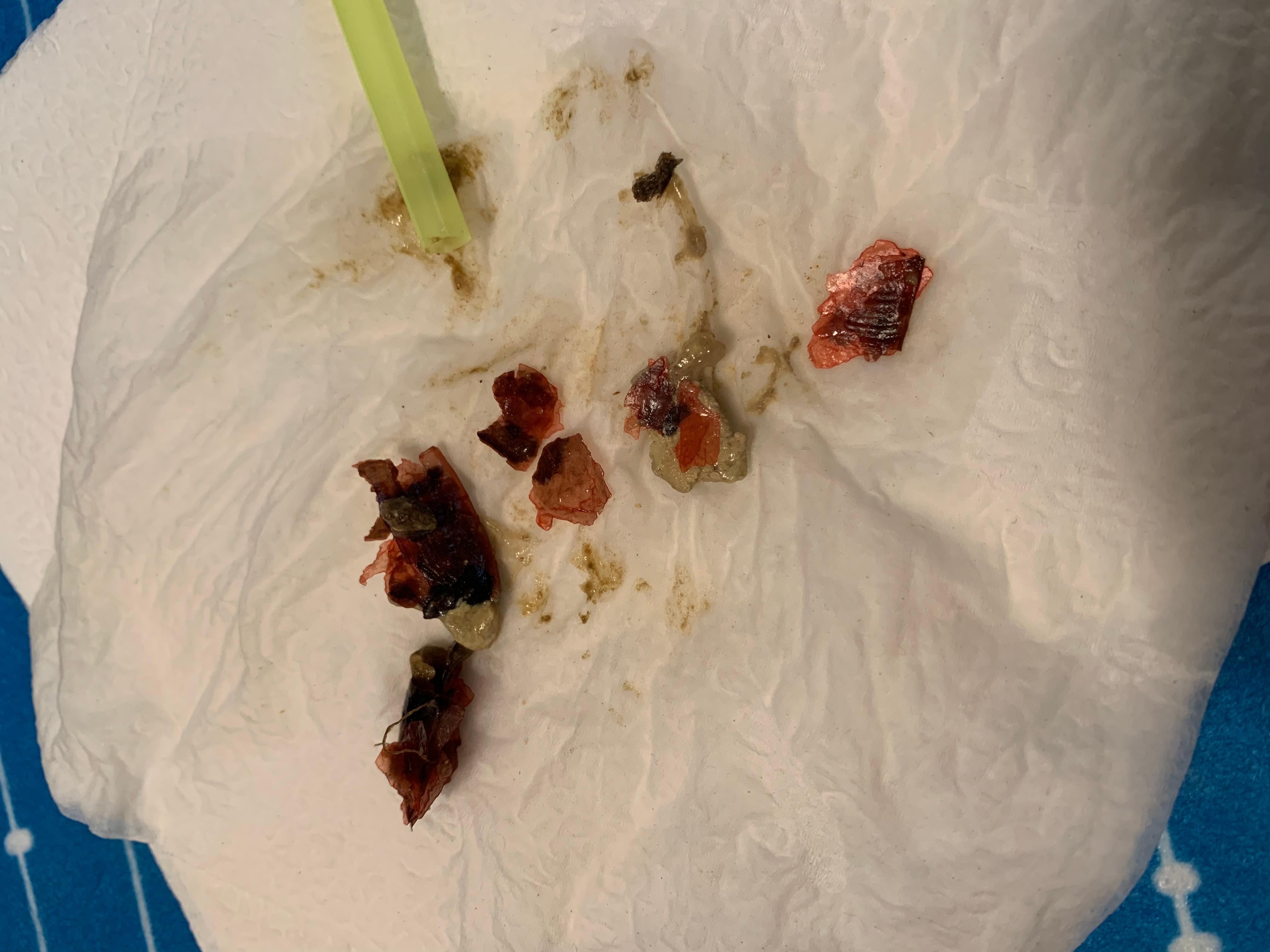 Question details sensitive content