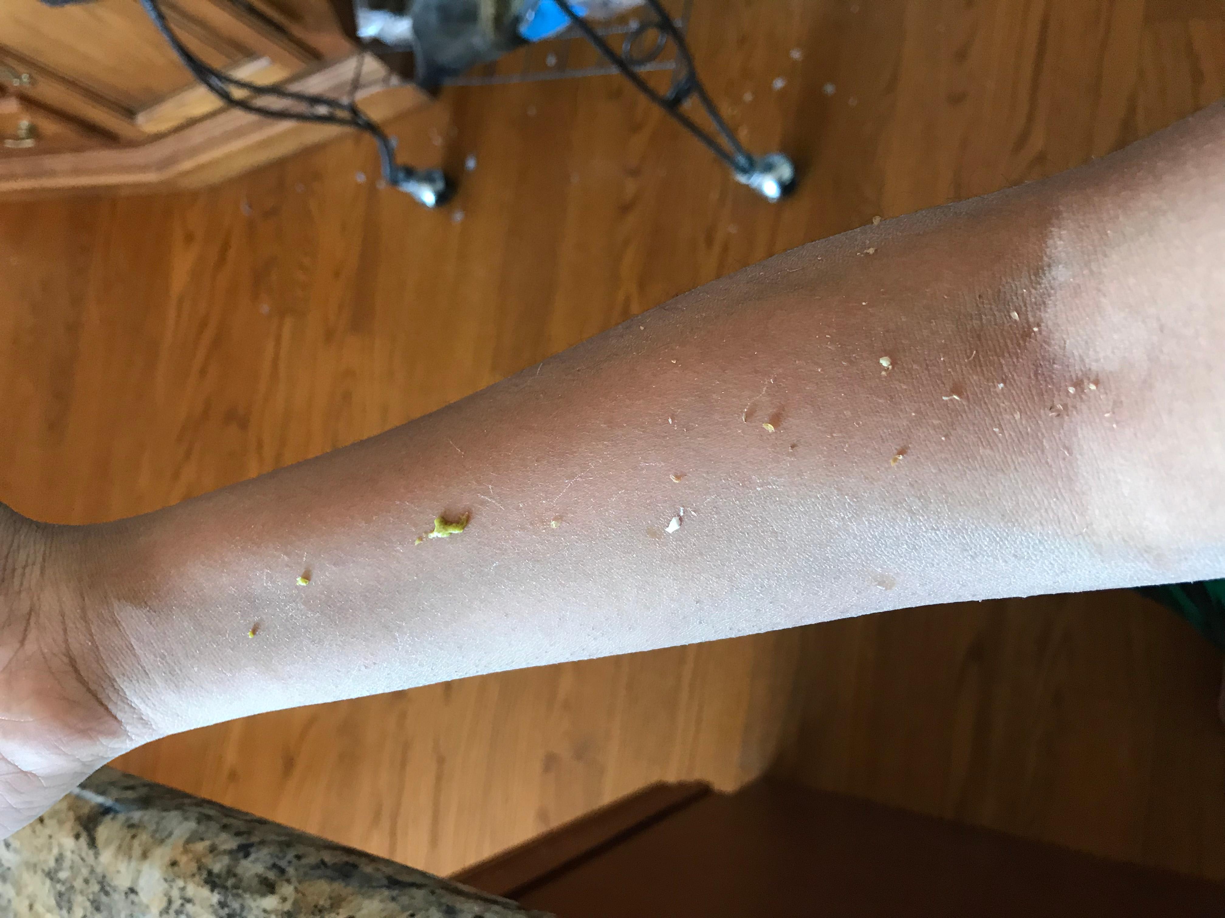 Question details sensitive content