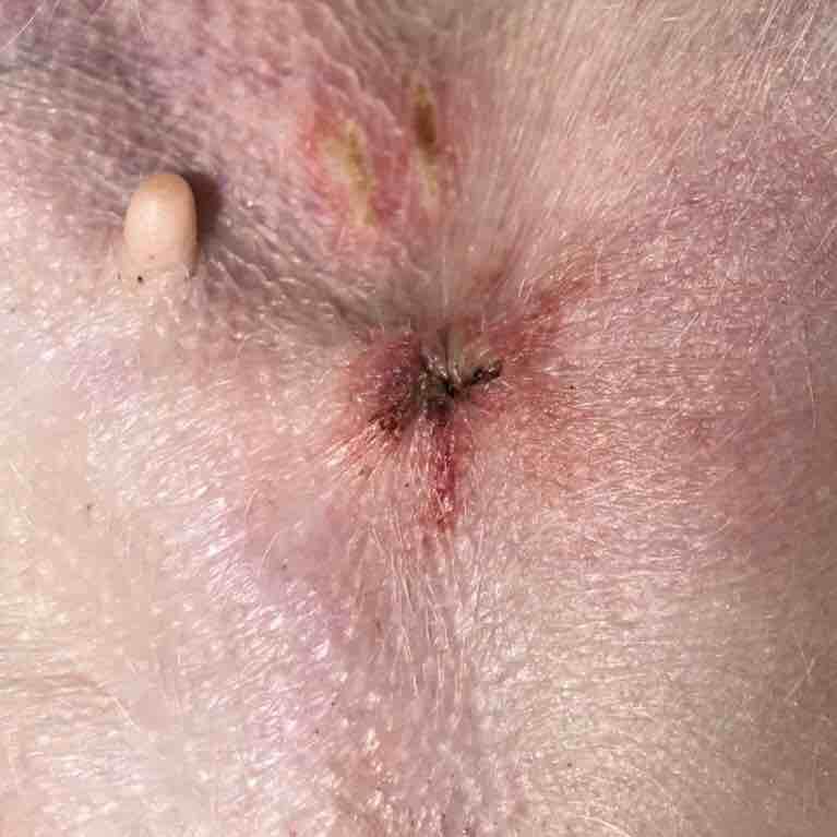 Question details sensitive content