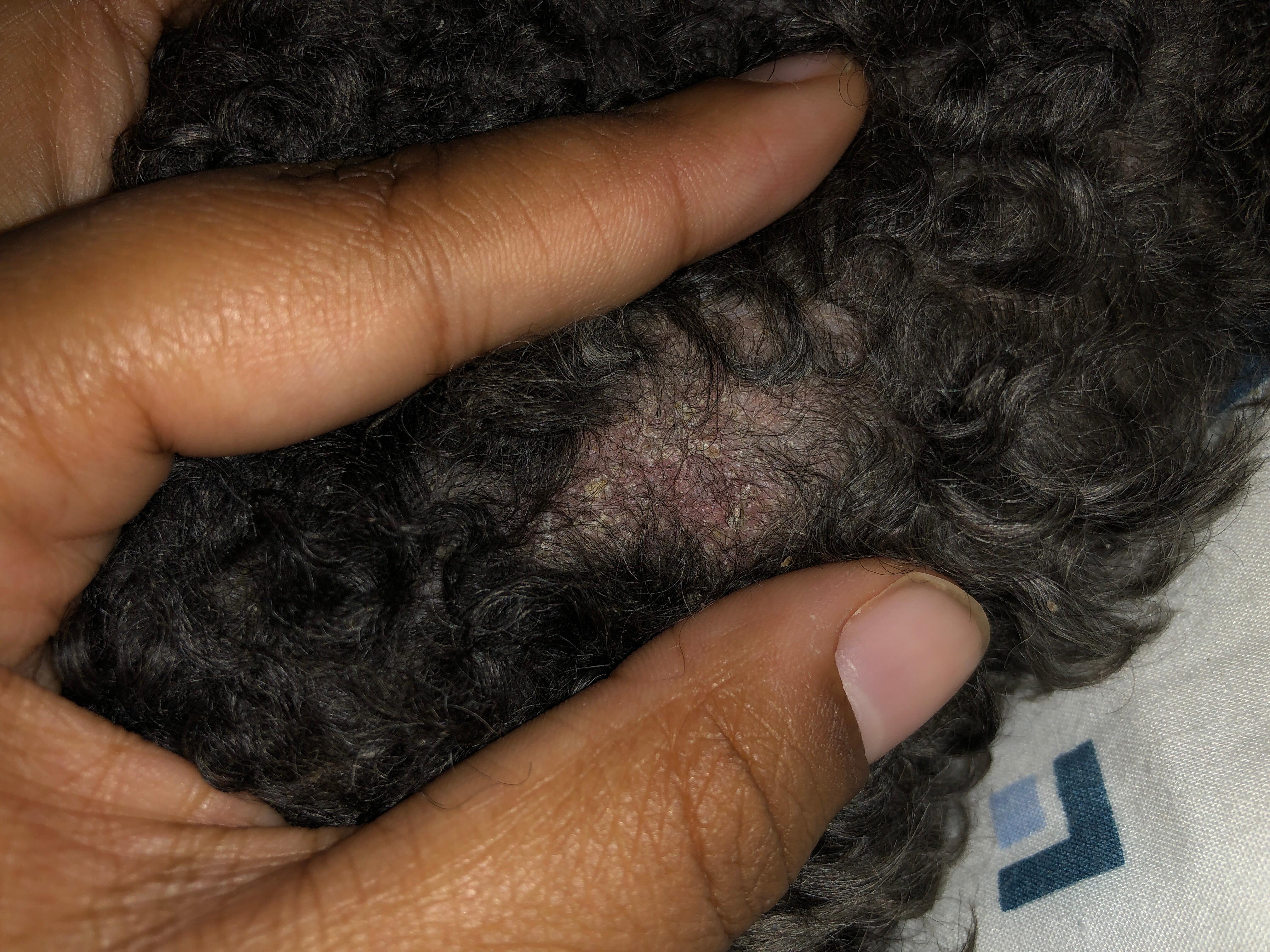 Question details sensitive content