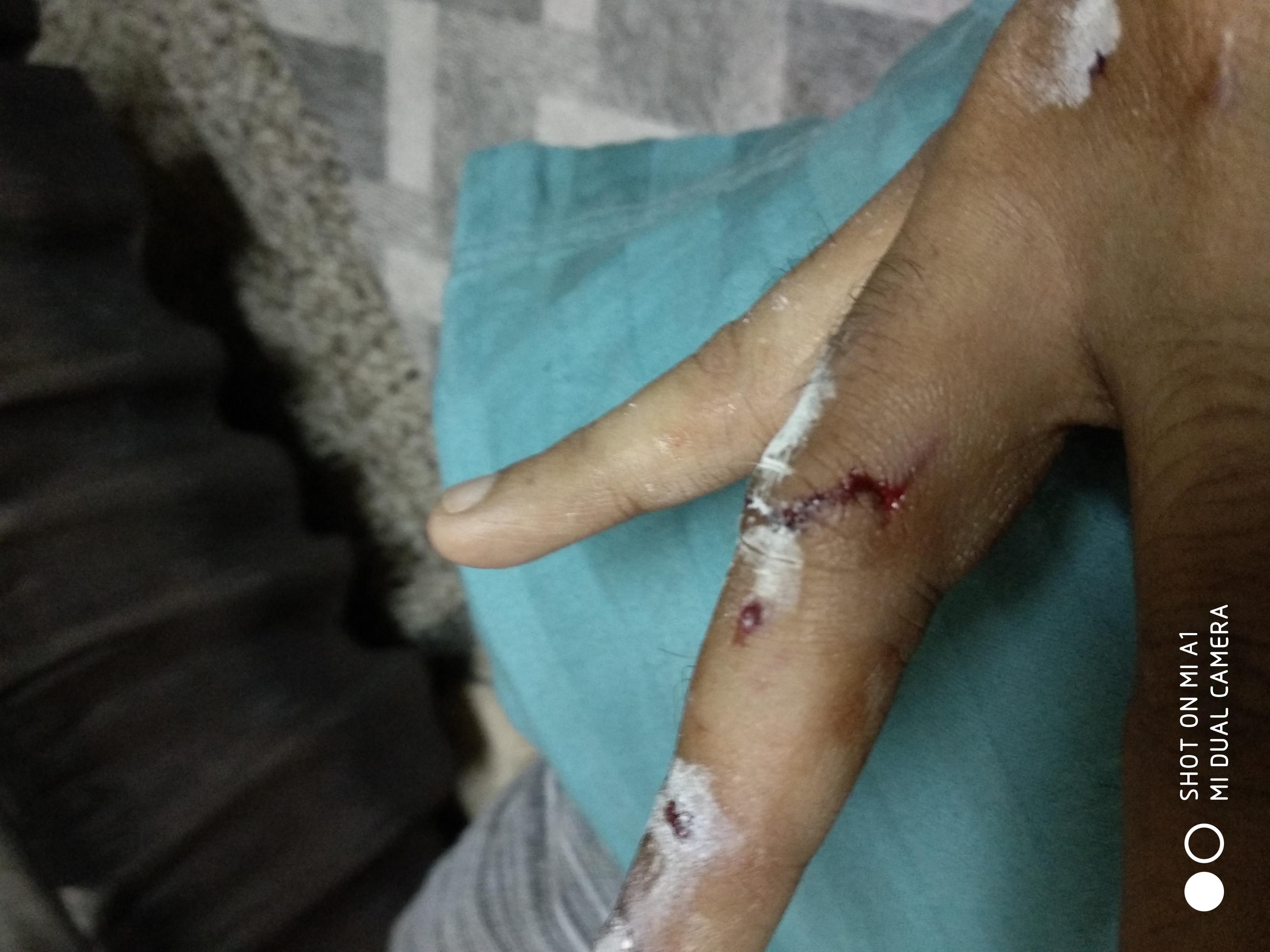 Question details sensitive content