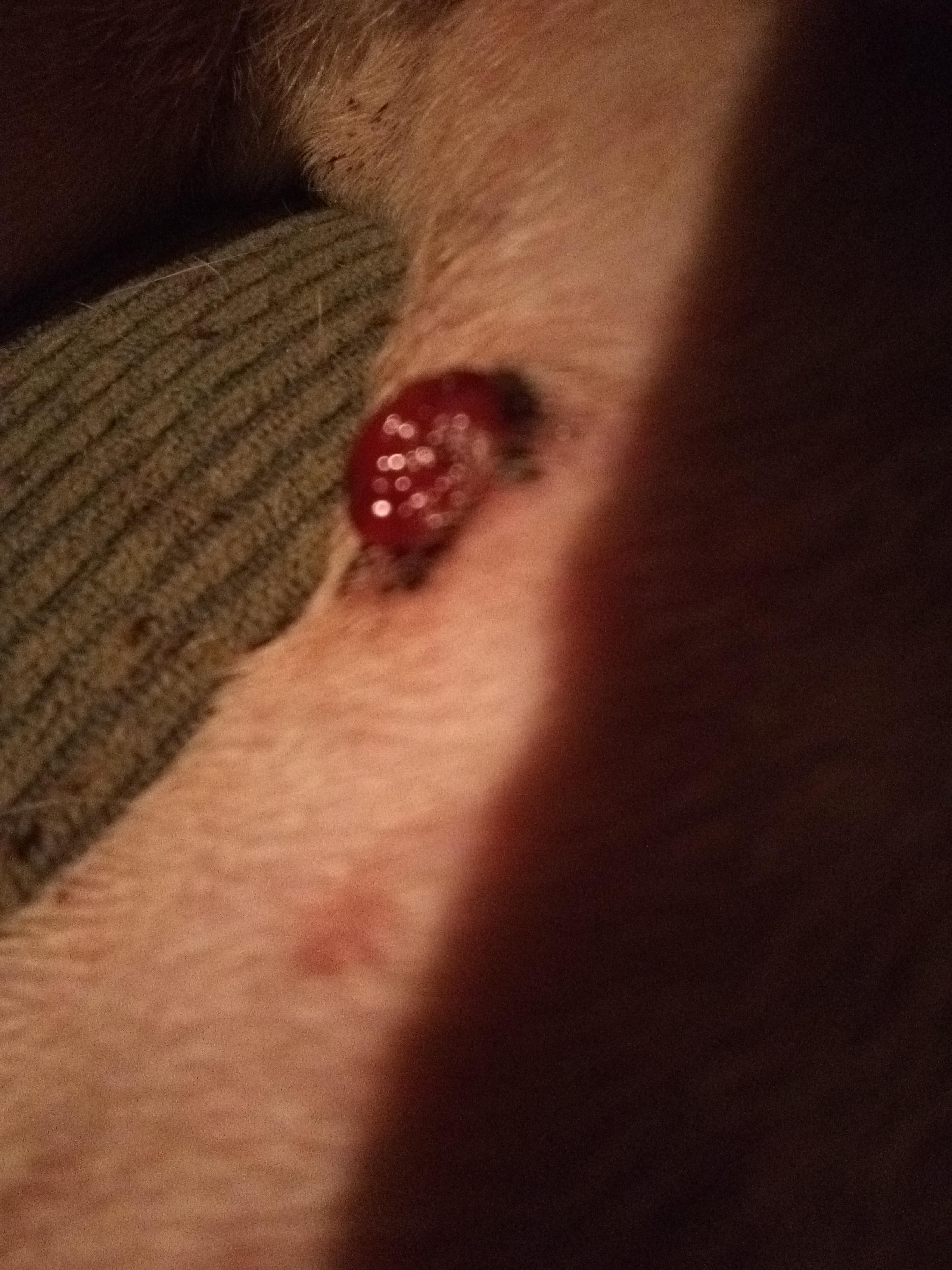 Question details sensitive content