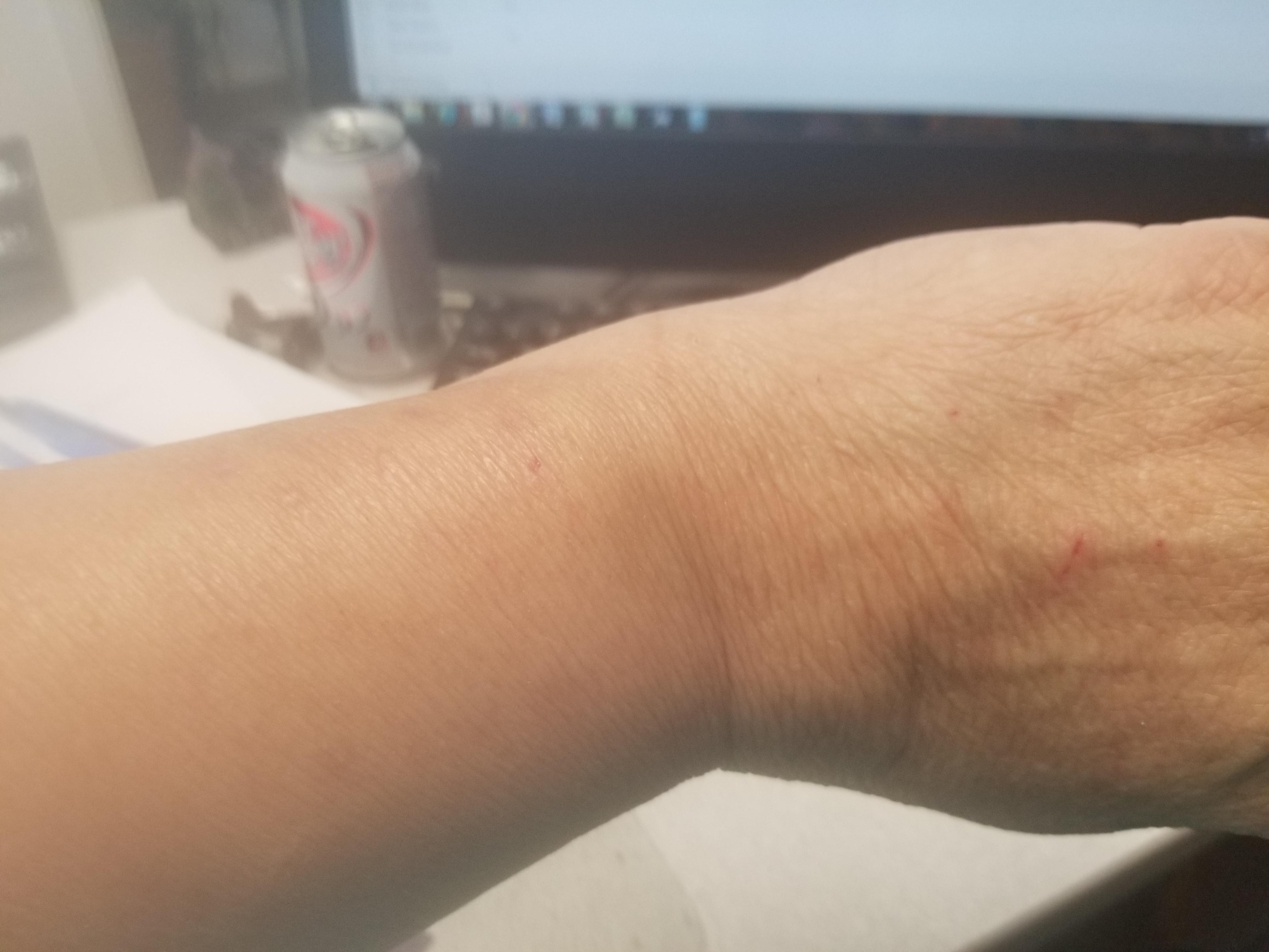 Question details sensitive content