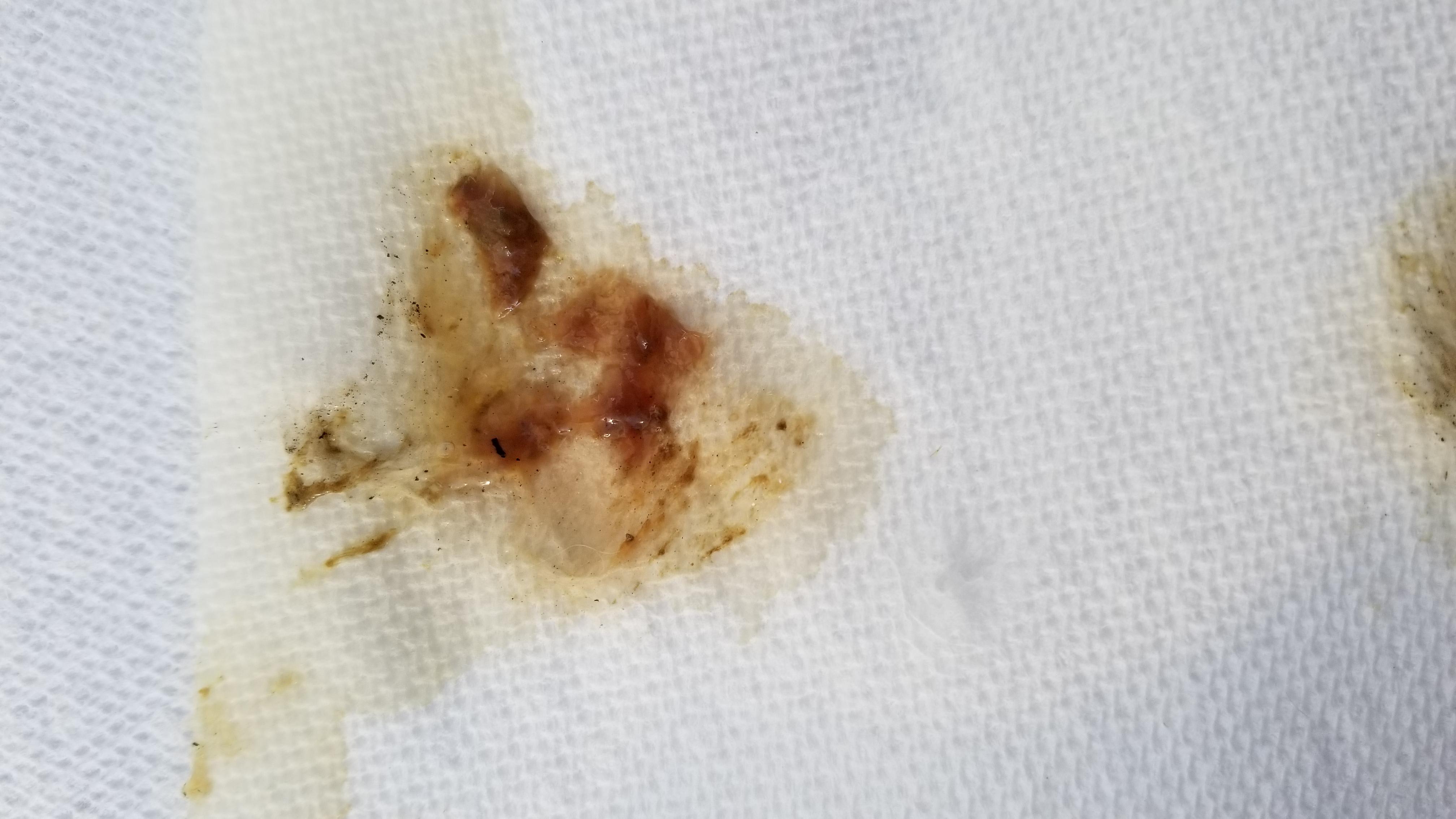 Question details sensitive content