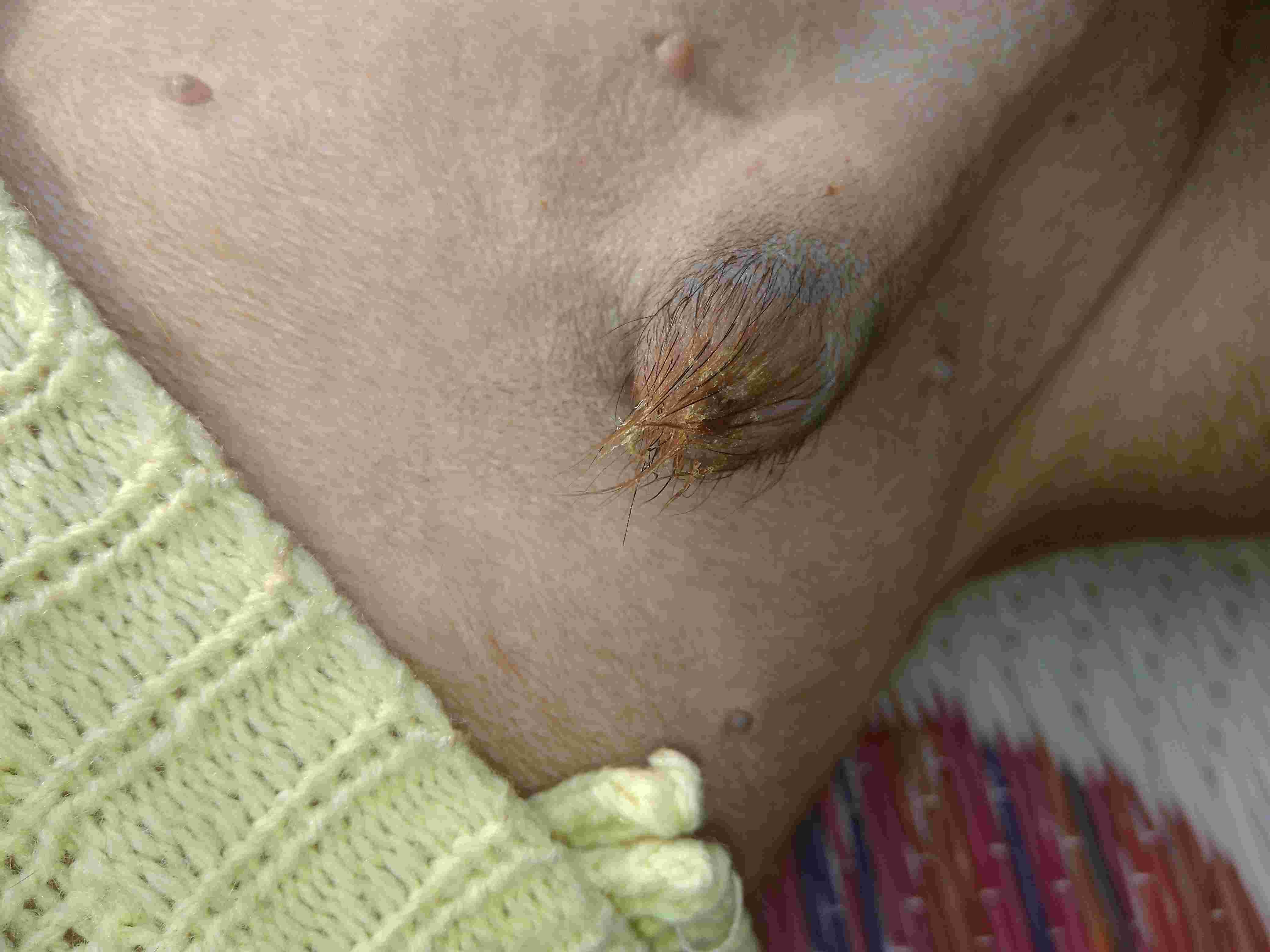 Question details sensitive content