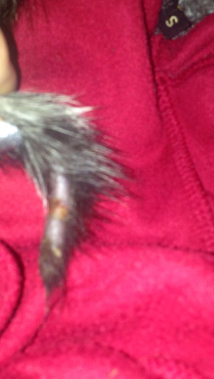 Question details sensitive content