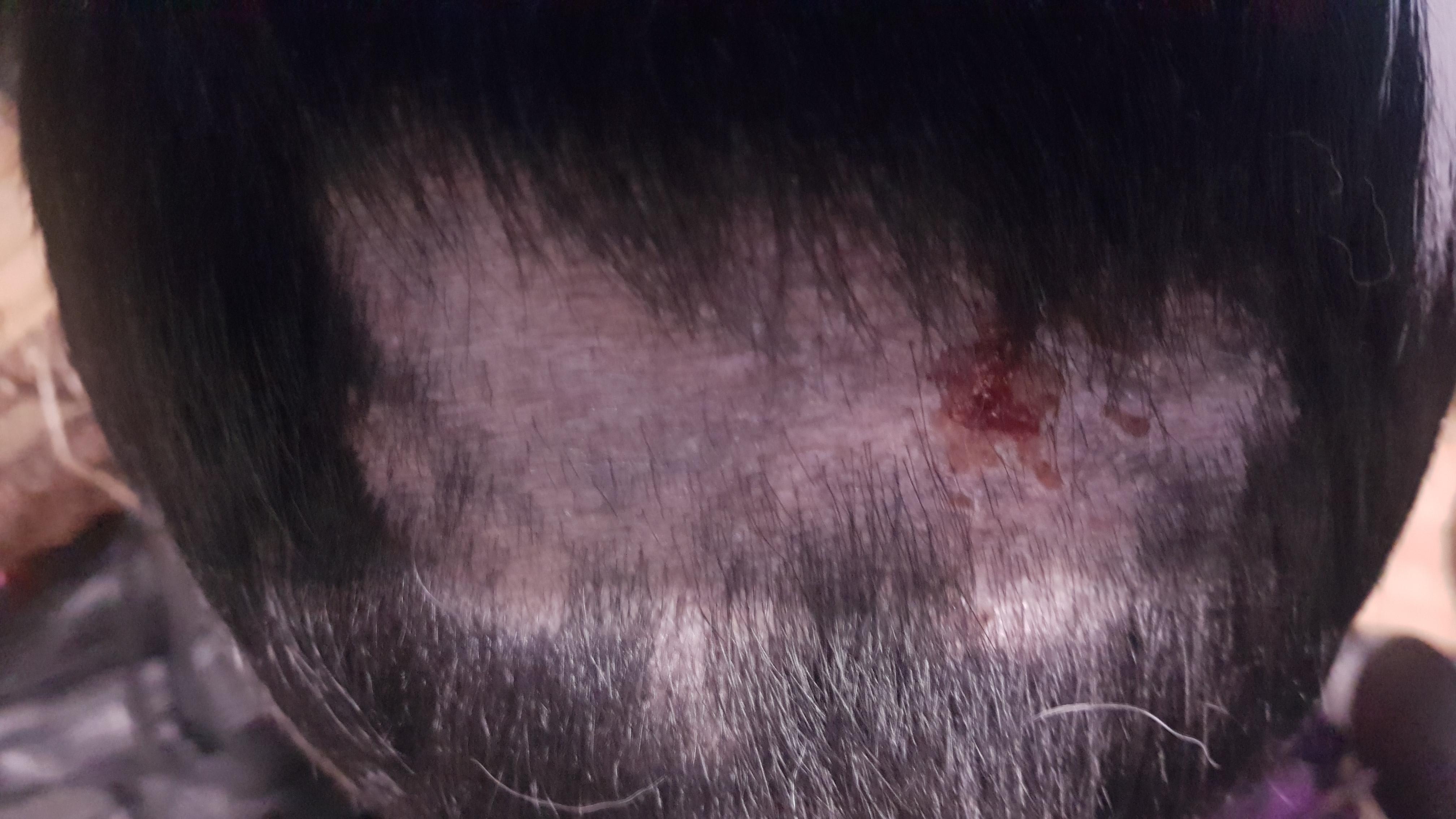 Question details sensitive content