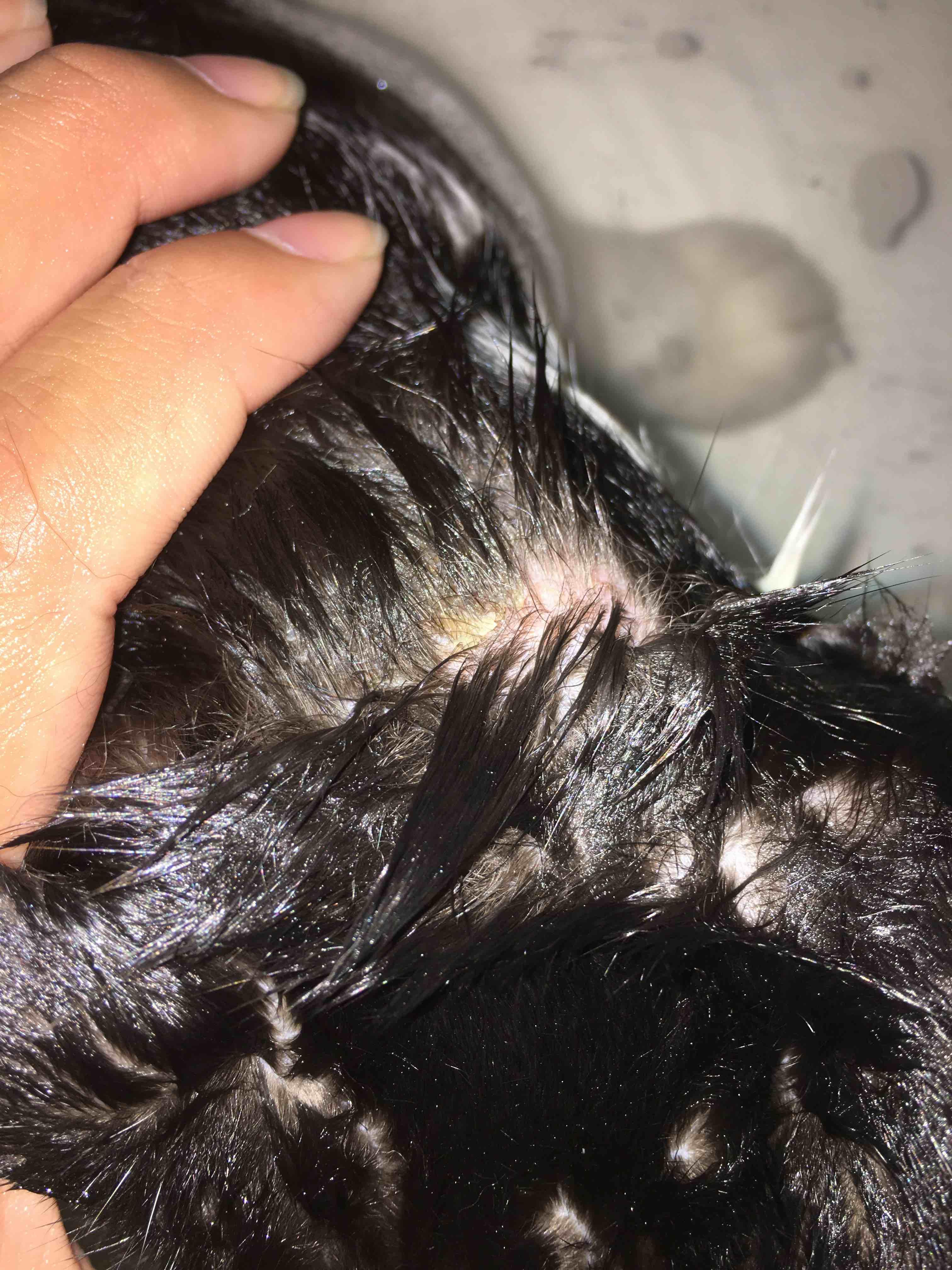 Question details sensitive content